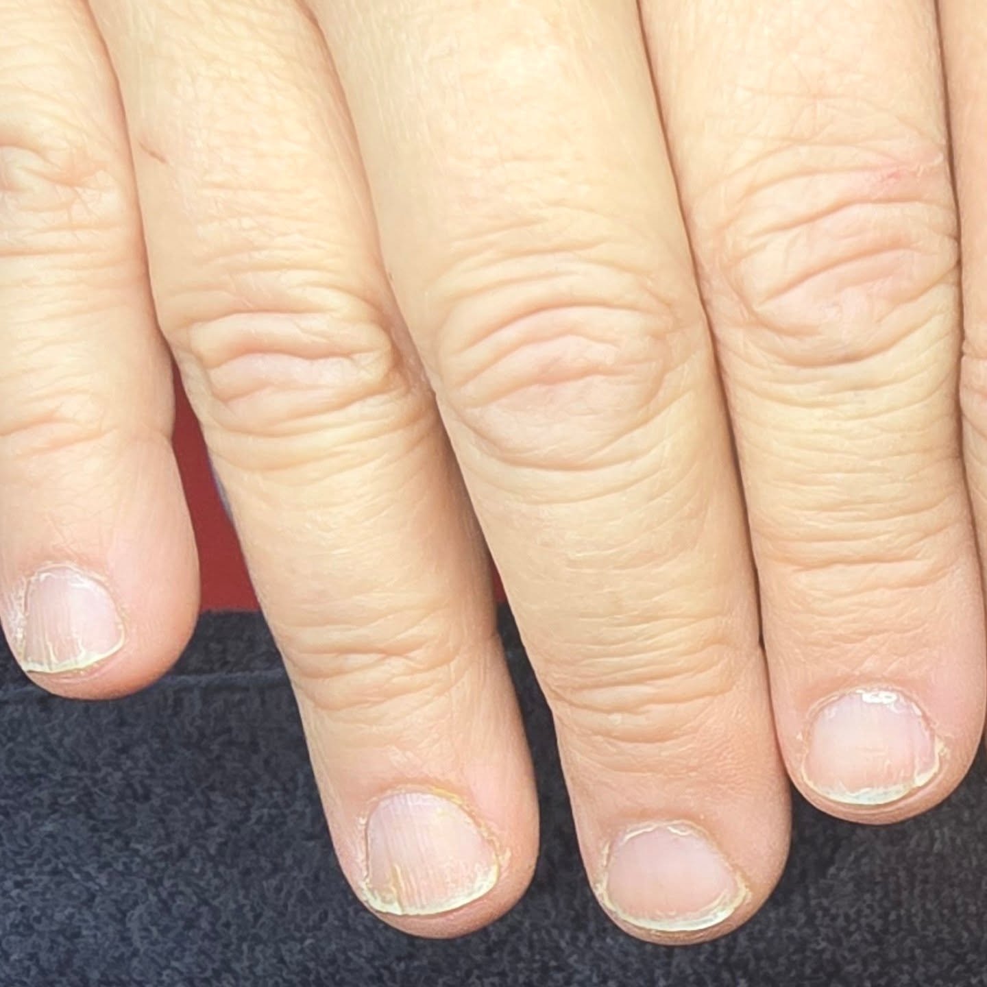 Got some before and afters for you! My client had dry sticky cuticles and thin oily nails. I only did gel polish for this round. Follow me to see beautiful transformations and to keep up on the progress of my client's nails.
#nail #nails #nailsnail