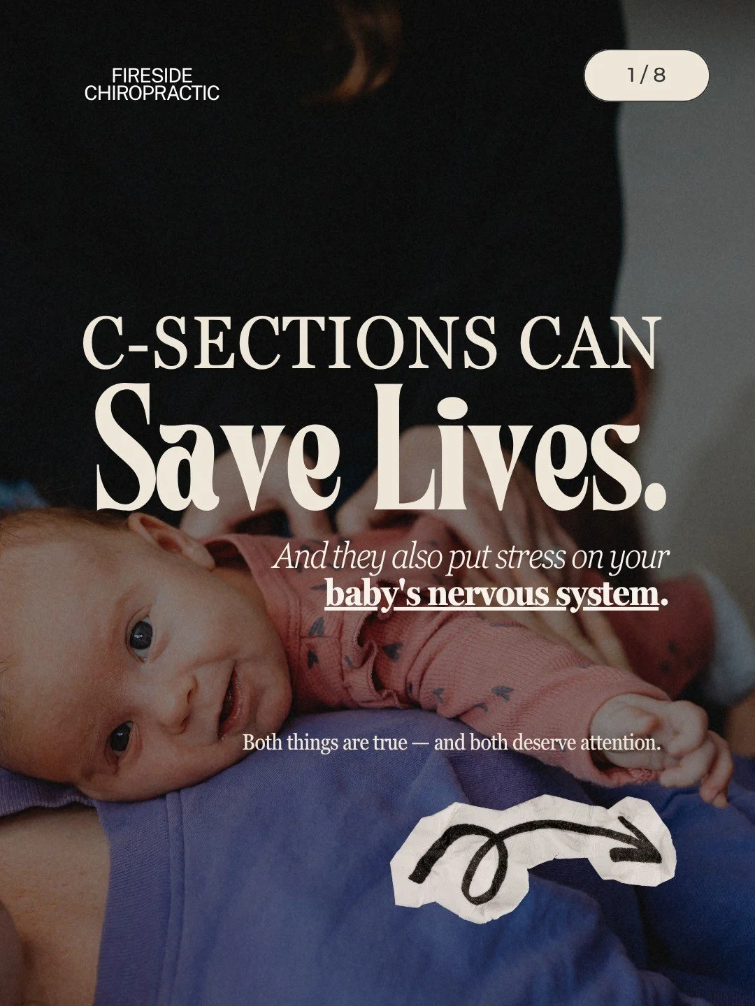 If you have had a csection, this is not about guilt &mdash; it's about understanding what your baby may need after.

Here's what happens during a vaginal birth that most people don't know:

As a baby moves through the birth canal, the gentle compress