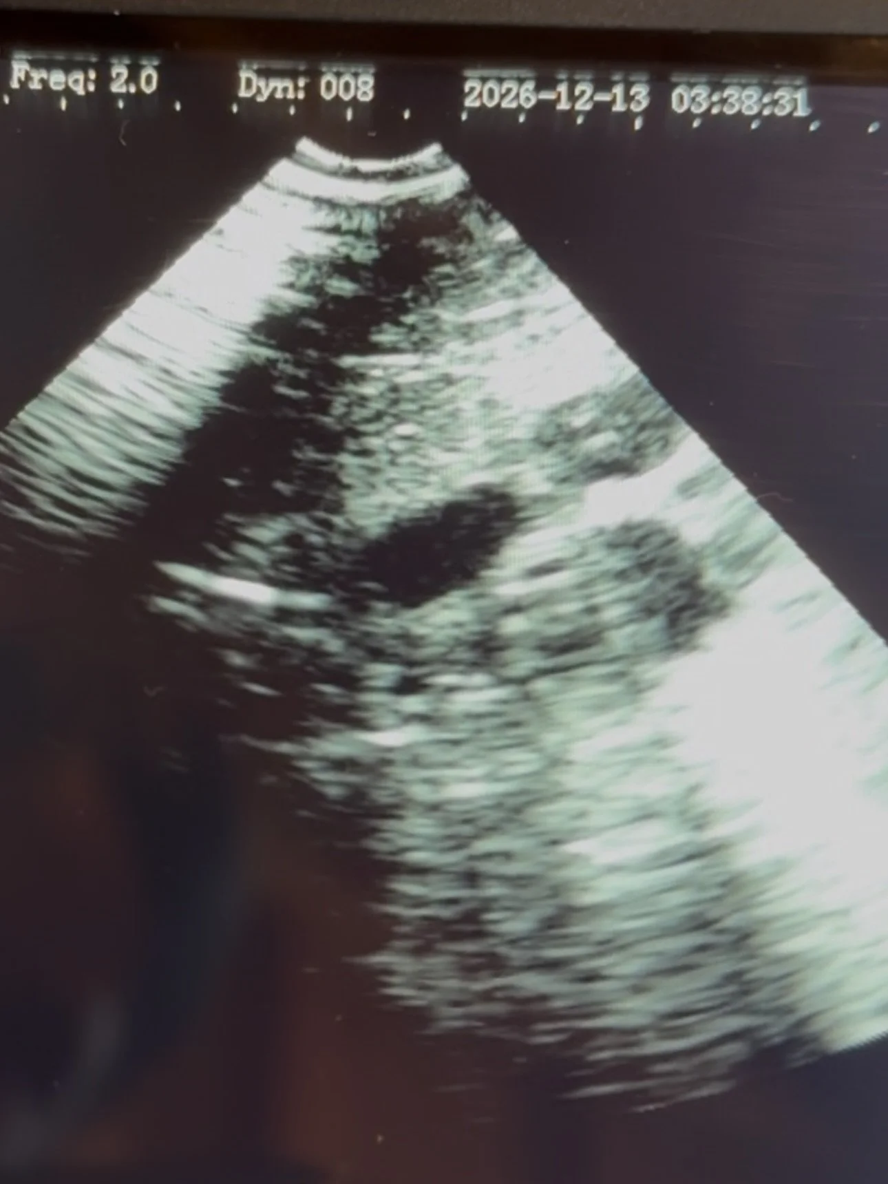 Artificial Insemination Mentoring Session