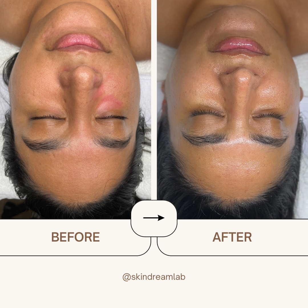 Beige Minimalist Skincare Before and After Instagram Post - 22.png