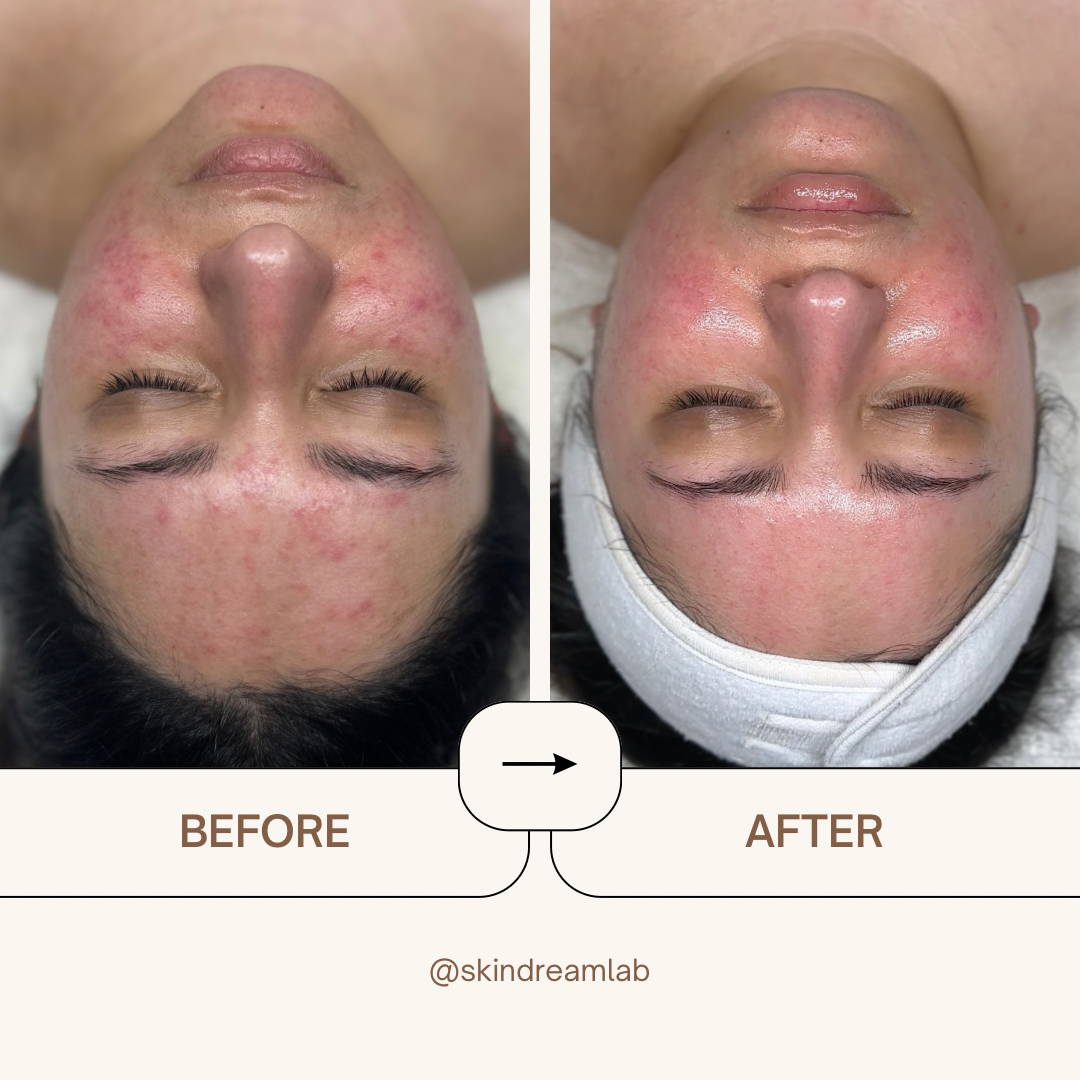 Beige Minimalist Skincare Before and After Instagram Post - 39.png