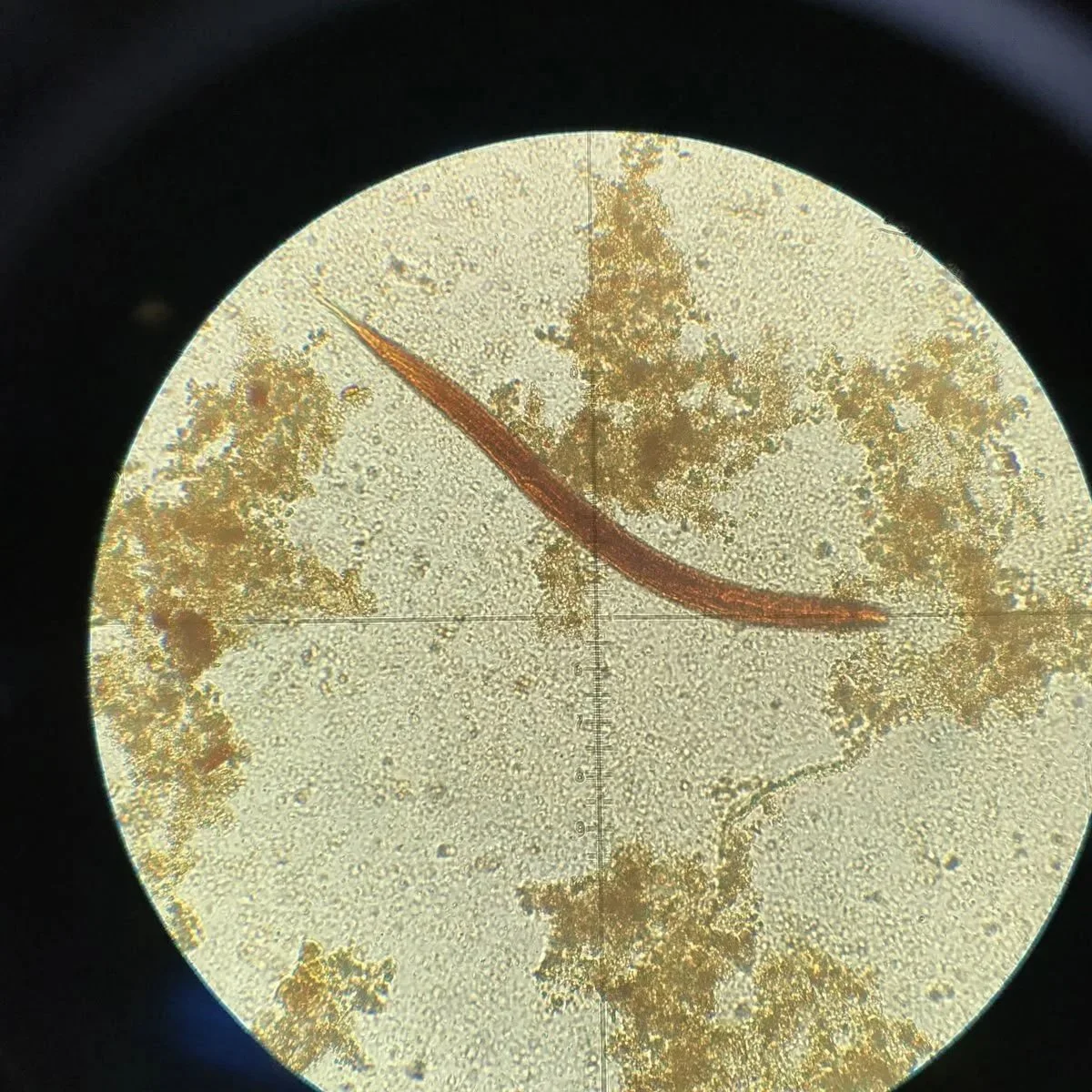 The Parasite Cleanse Controversy