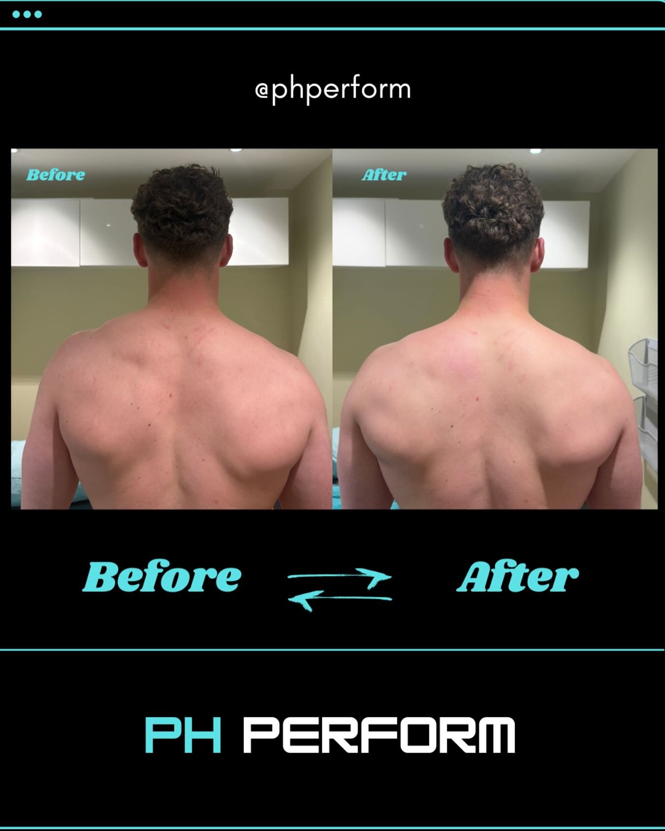 Before & After!
A positive shoulder/upper back treatment for @joe.rob_ π€
Came in with shoulder pain & tension π€
Came out pain free & relaxed π
Joe plays rugby at a high level. After a long season he had a few niggles that needed rel