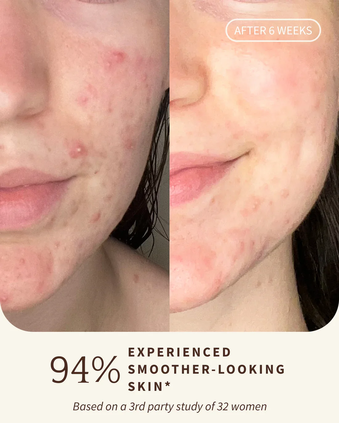 3_BakuchiolBRIGHTENINGSERUM6.jpg.webp