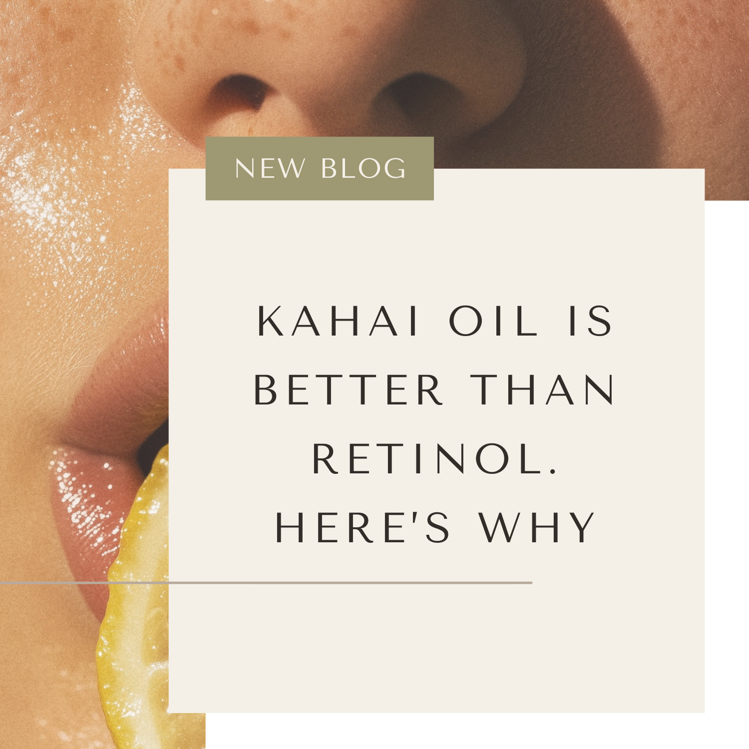 If Retinol Irritates Your Skin, Read This Before Buying Another Product