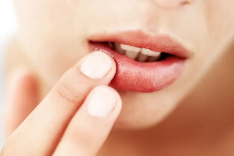 Best Remedies for Dry Lips Using Natural Butters and Masks