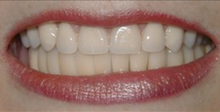 Screen Shot 2016-10-27 at 8.31.21 AM.png