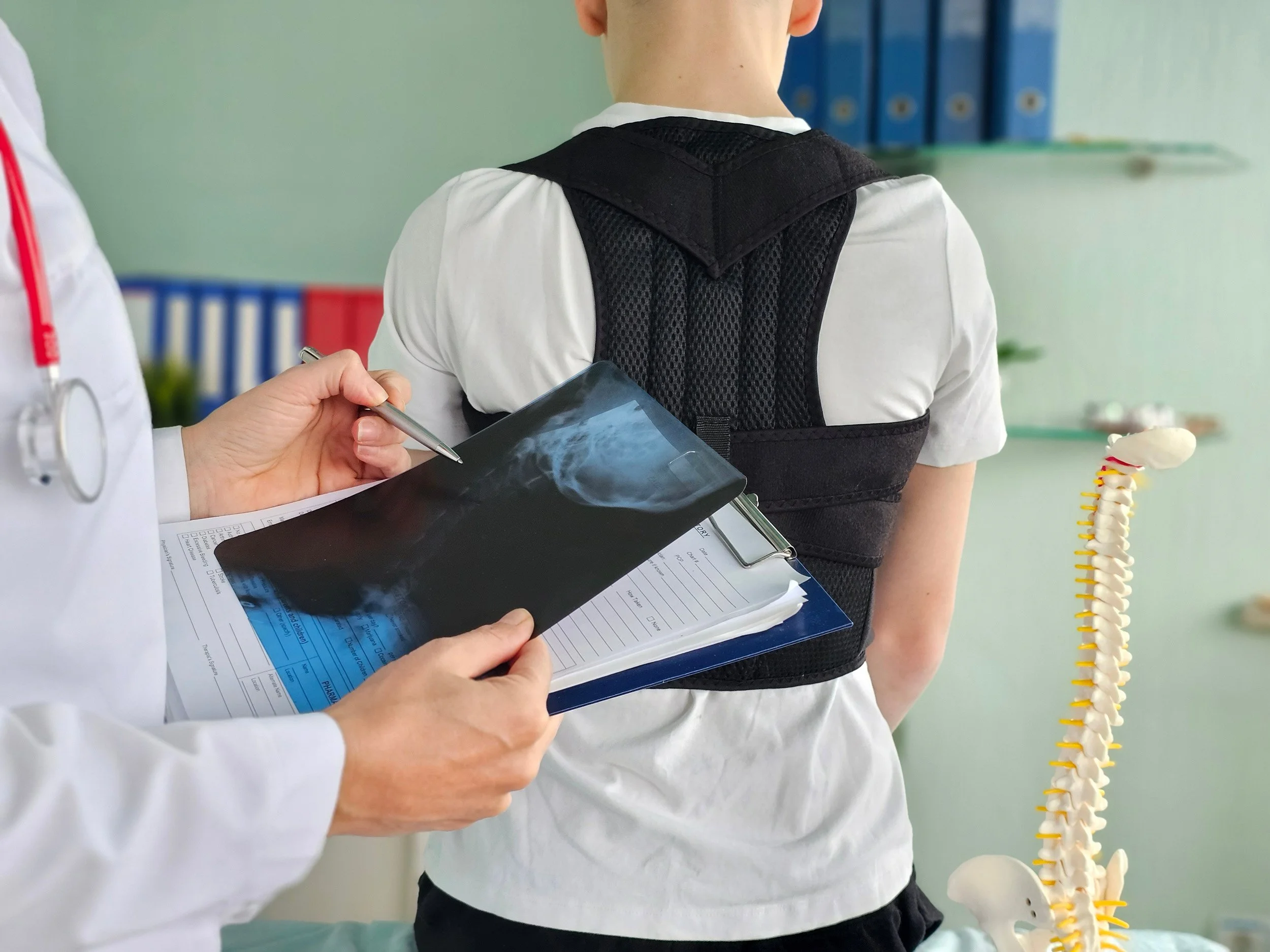 Doctor examining an X-ray with a patient wearing a posture brace and a spine model in the background.