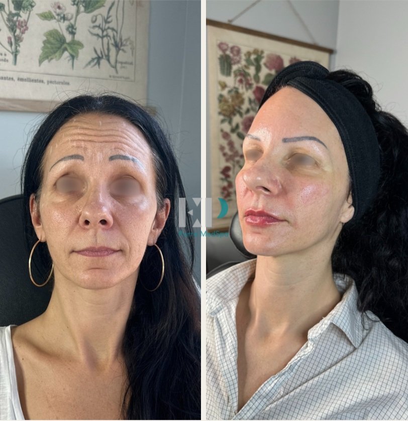 SeptemberOctober 2024 Purra.jpg