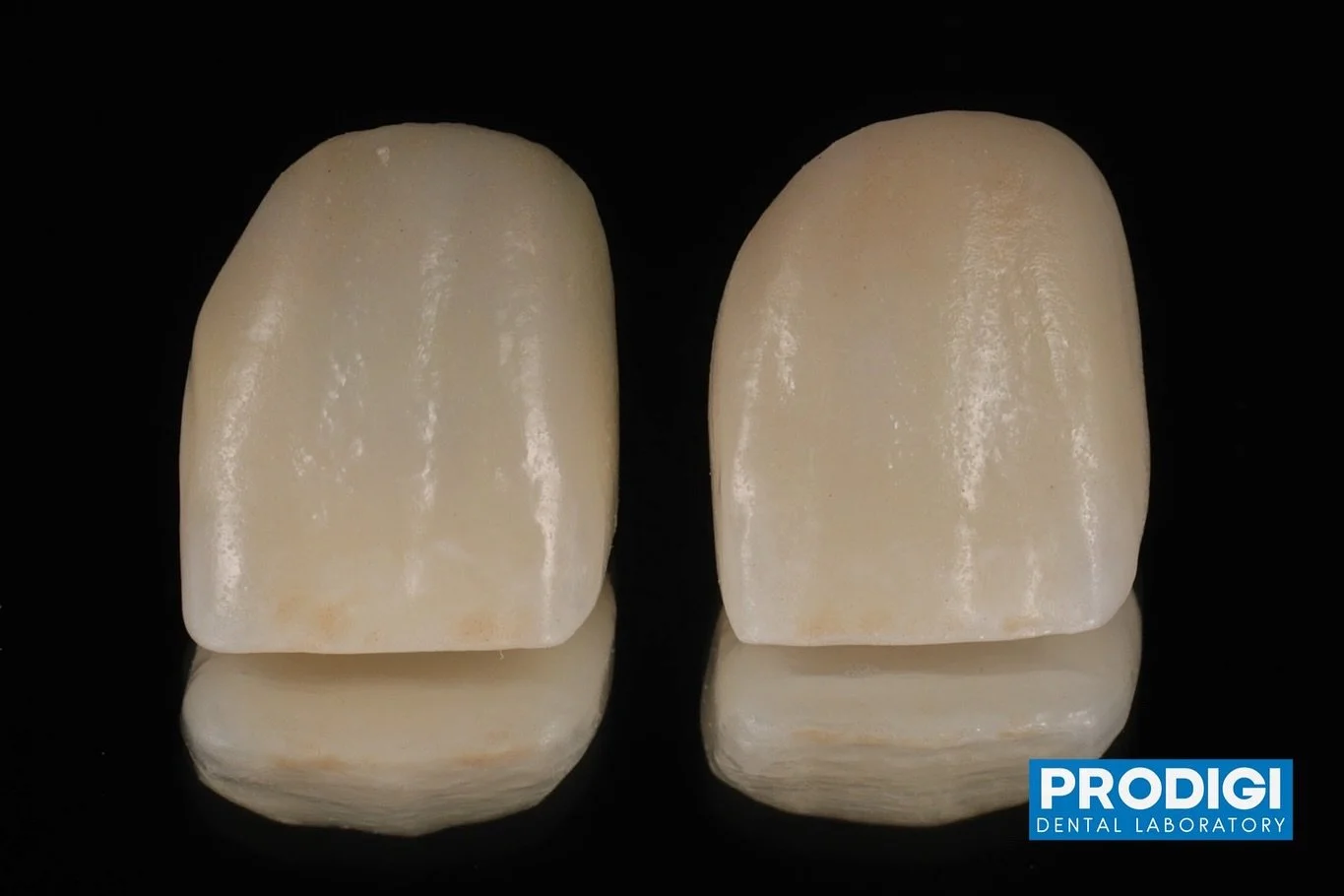 Single shade matching.
Fabricating both zirconia and lithium discilicate crown to confirm which results in best aesthetics for the patient.
With @prostho.dental