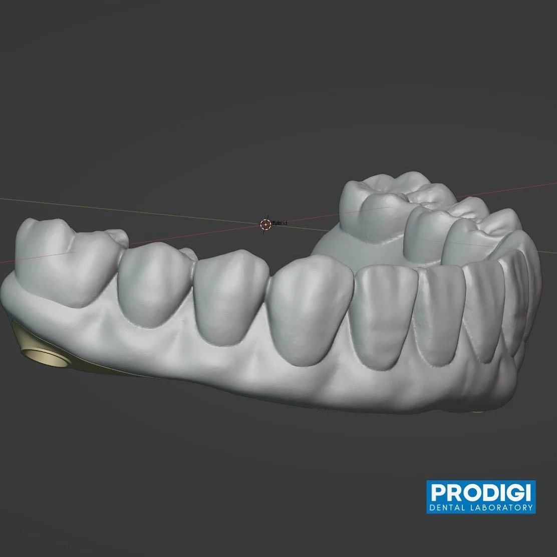 Designing for metal sub-structure for all-on-X prosthetics. @prodigi_dentallab