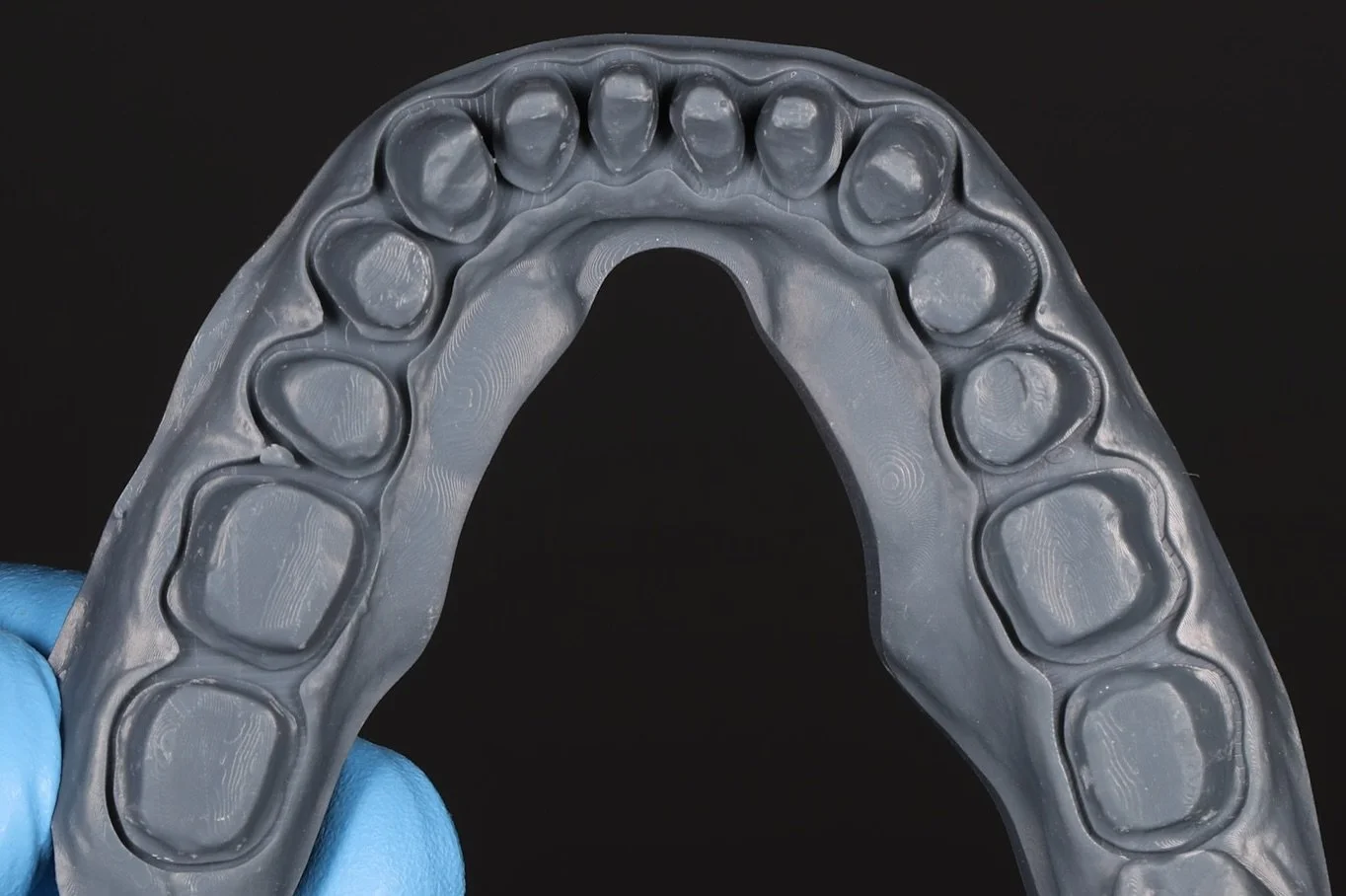 Digital workflow using captured STL file @prodigi_dentallab 
With @dr_djshin