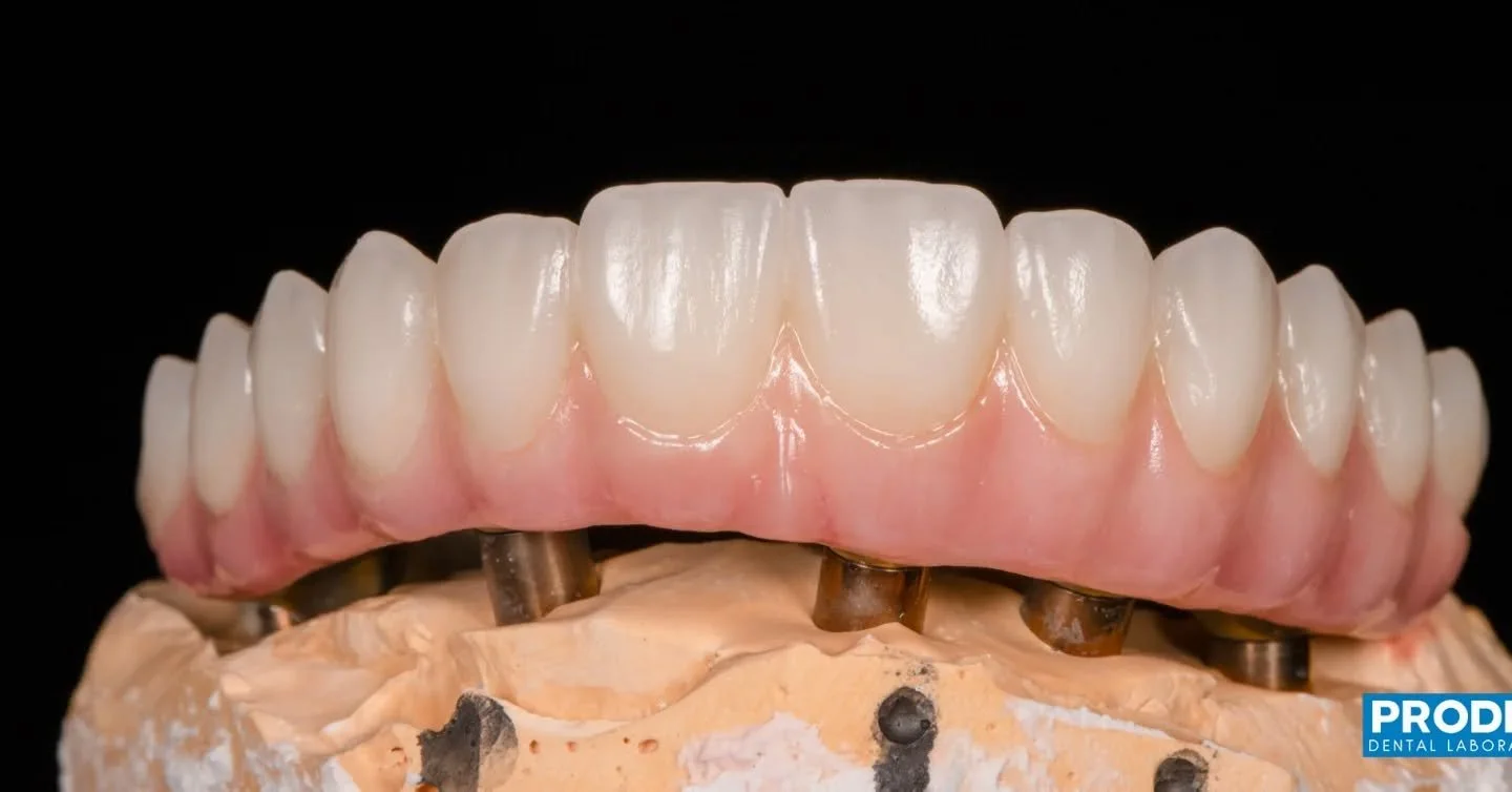 Upper and lower full-arch zirconia all on x restorations supported by custom titanium bars 💪
Designed for optimal strength, precision fit, and natural esthetics &mdash; where digital design meets craftsmanship.
#AllOnX #FullArchRehabilitation #Zirco