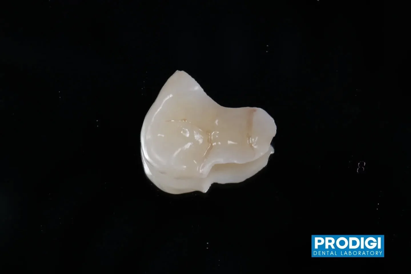 Etched zirconia inlay designed for maximum bonding strength and long-term durability 🔒🦷
#ZirconiaInlay #BondingStrength #Prosthodontics #DigitalDentistry #ProdigiDentalLab