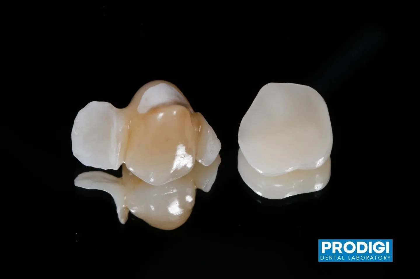 Zirconia Maryland bridge with etched surfaces &mdash; engineered for maximum bond and esthetic integration ✨
#Zirconia #BondingStrength #DentalRestorations #ProdigiDentalLab