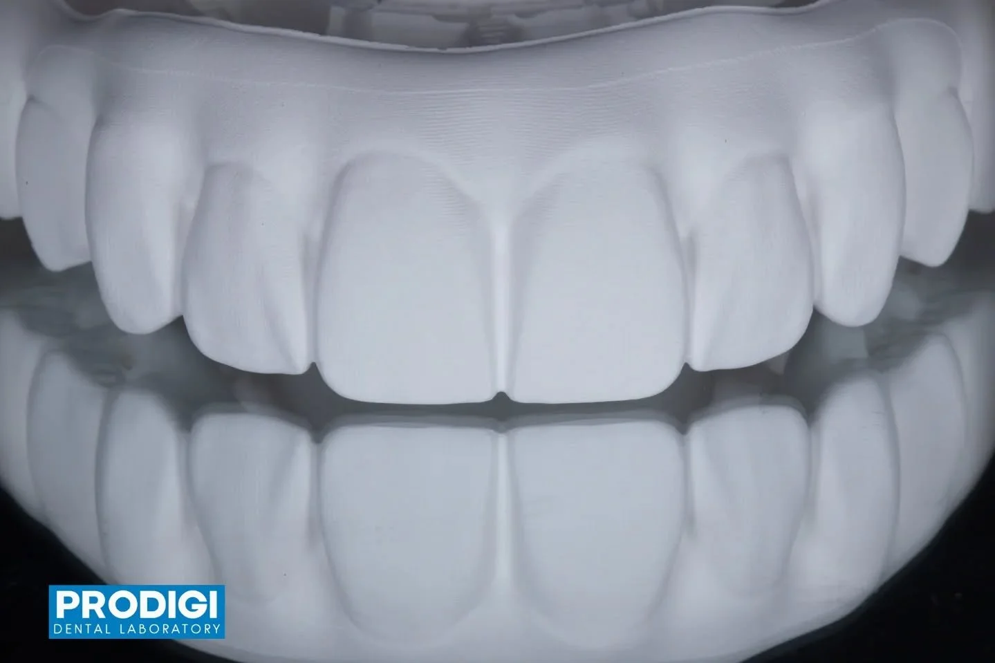 Upper and lower All-on-X restorations milled using the 90&deg; milling technique on the Craft5X milling machine 🦷
Precision milling allows optimal tool access, detailed anatomy, and a superior surface finish for full-arch restorations.
#AllOnX #Craf