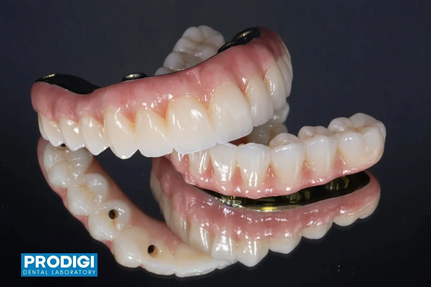 Full-arch maxillary and mandibular All-on-X restorations utilizing monolithic zirconia prostheses supported by custom titanium bars for optimal strength, passive fit, and long-term durability.

#craft5x #AllOnX #ibar #exocad #ProdigiDentalLab