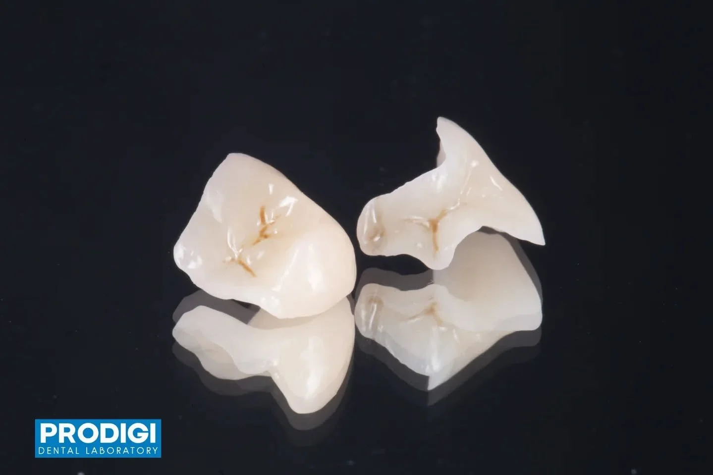 Craft5X milled onlays with VITA ENAMIC &mdash; durable, precise, and minimally invasive 👌
#OnlayRestoration #DigitalWorkflow #DentalCeramics #ProdigiDentalLab