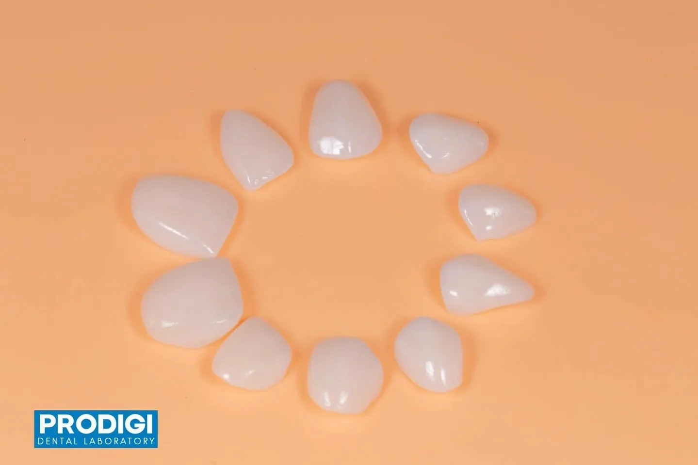 10 veneers combined with monolithic posterior restorations and anterior cutback with porcelain buildup 🦷✨
Balancing strength in the posterior with layered esthetics in the anterior for a seamless full-arch result.
#Veneers  #FullMouthRehab #Prosthod