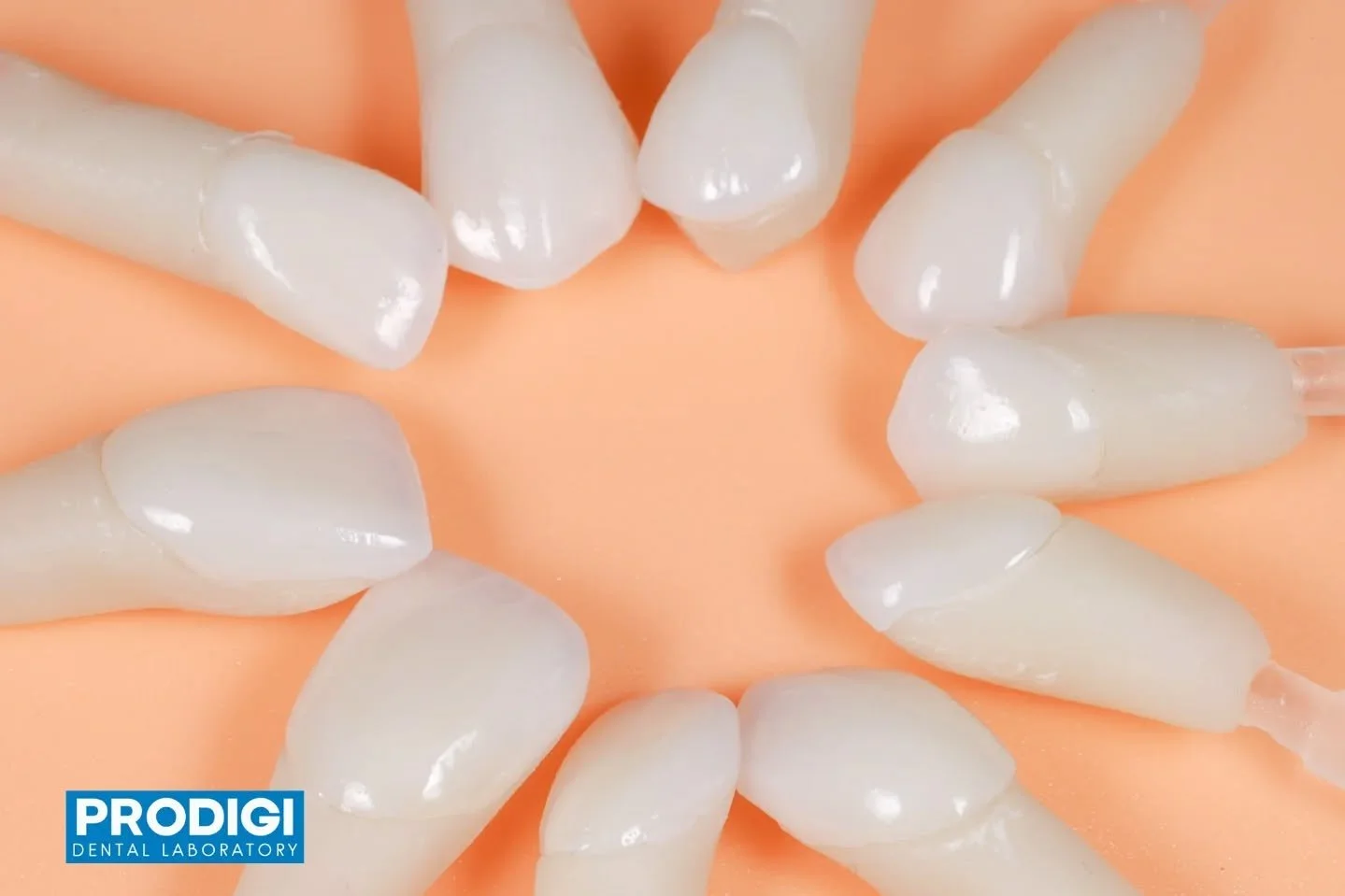 10-unit veneer case crafted in lithium disilicate 🦷✨
Designed for seamless esthetics, natural translucency, and a harmonious full-smile transformation. Where precision meets artistry.
#LithiumDisilicate #Veneers #Prosthodontics #ProdigiDentalLab