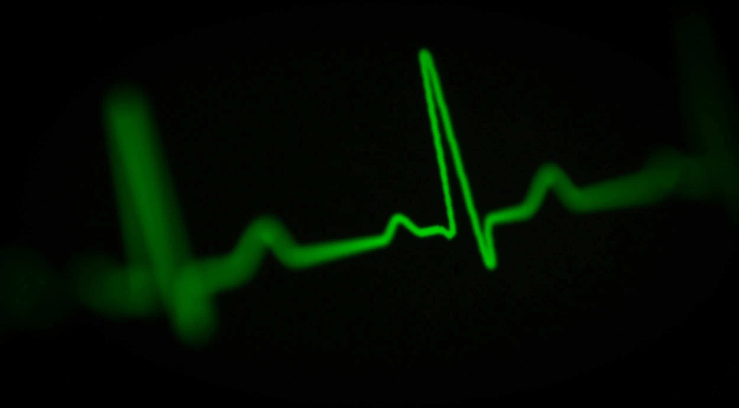 Heart Rate Variability: What It Reveals About Stress and Recovery