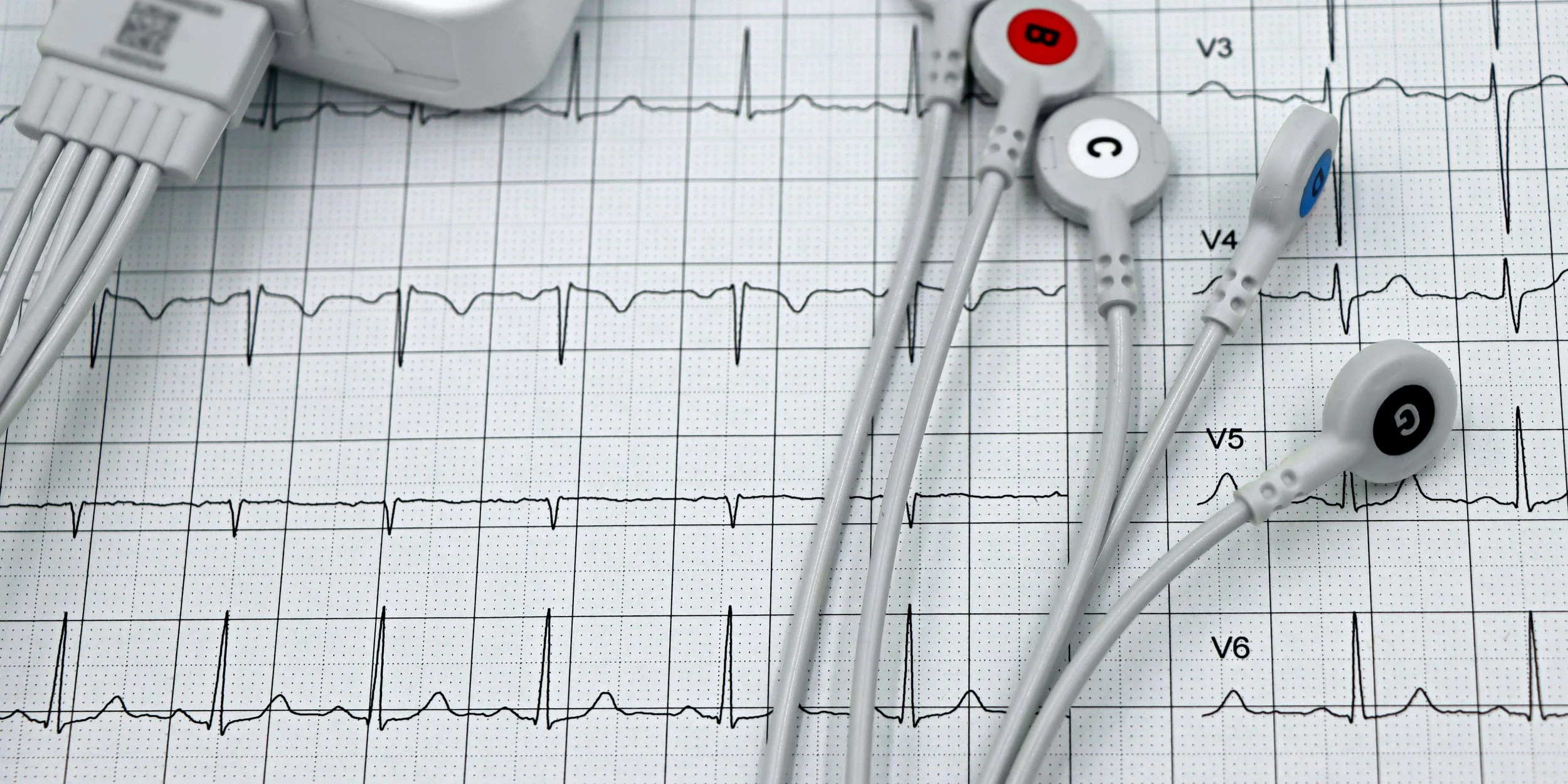 Medical ECG printout with four colorful electrode stickers—red, white, blue, and black—placed on top.
