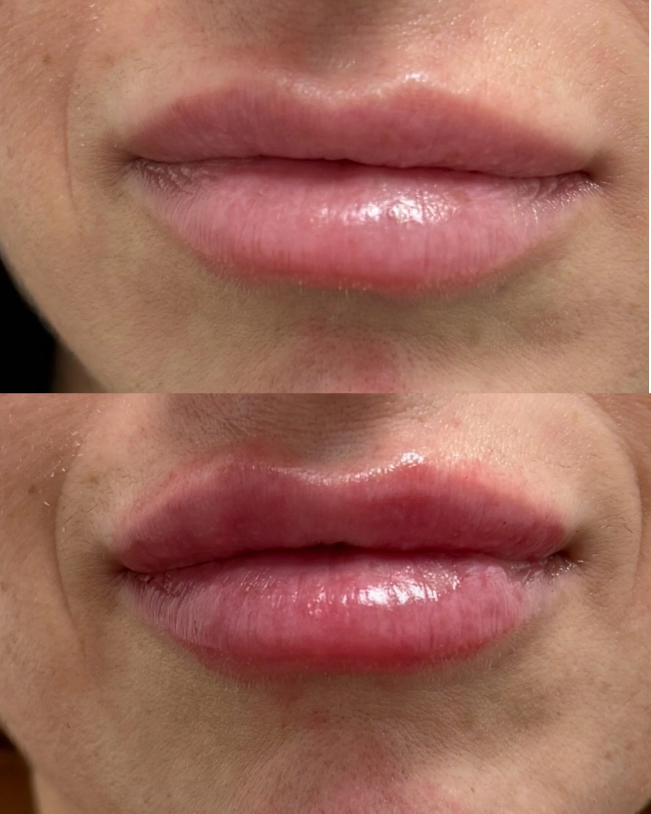 Close-up of a person's mouth with slightly parted lips.
