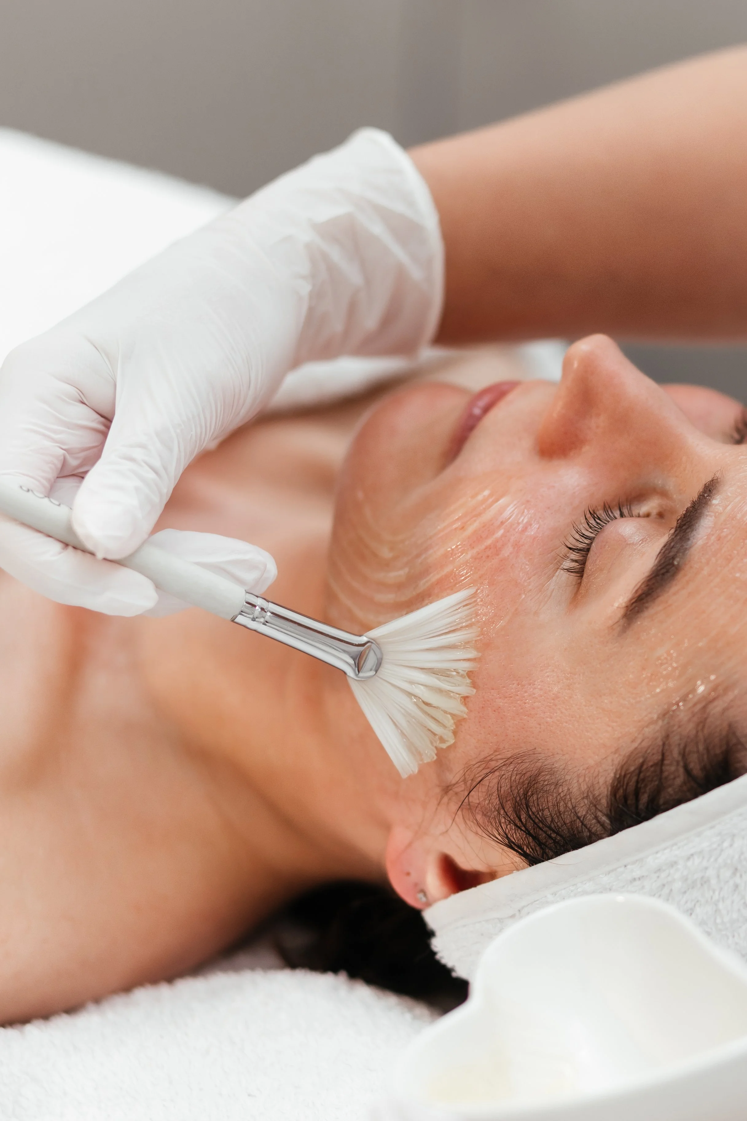 Medspa in La Mesa, CA, 91942 Chemical Peels Near Me