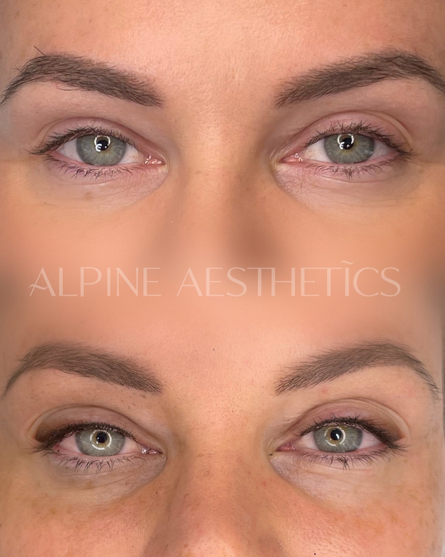 SHADED / FOXY LINER 🔥
I had to show these from the front — they’re just too good not to! 😍
This soft, shaded eyeliner heals like an absolute dream. No more smudging, fading, or spending 20 minutes perfecting your wings. You’ll li