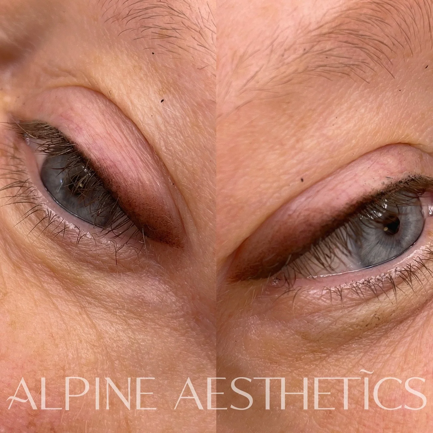 - FOXY LINER - Another gorgeous foxy liner for a beautiful client of mine. These have been such incredible cosmetic tattoos. Very popular. 

A treatment that is designed to take the hindrance of applying eye makeup daily. 

Let&rsquo;s enhance your e