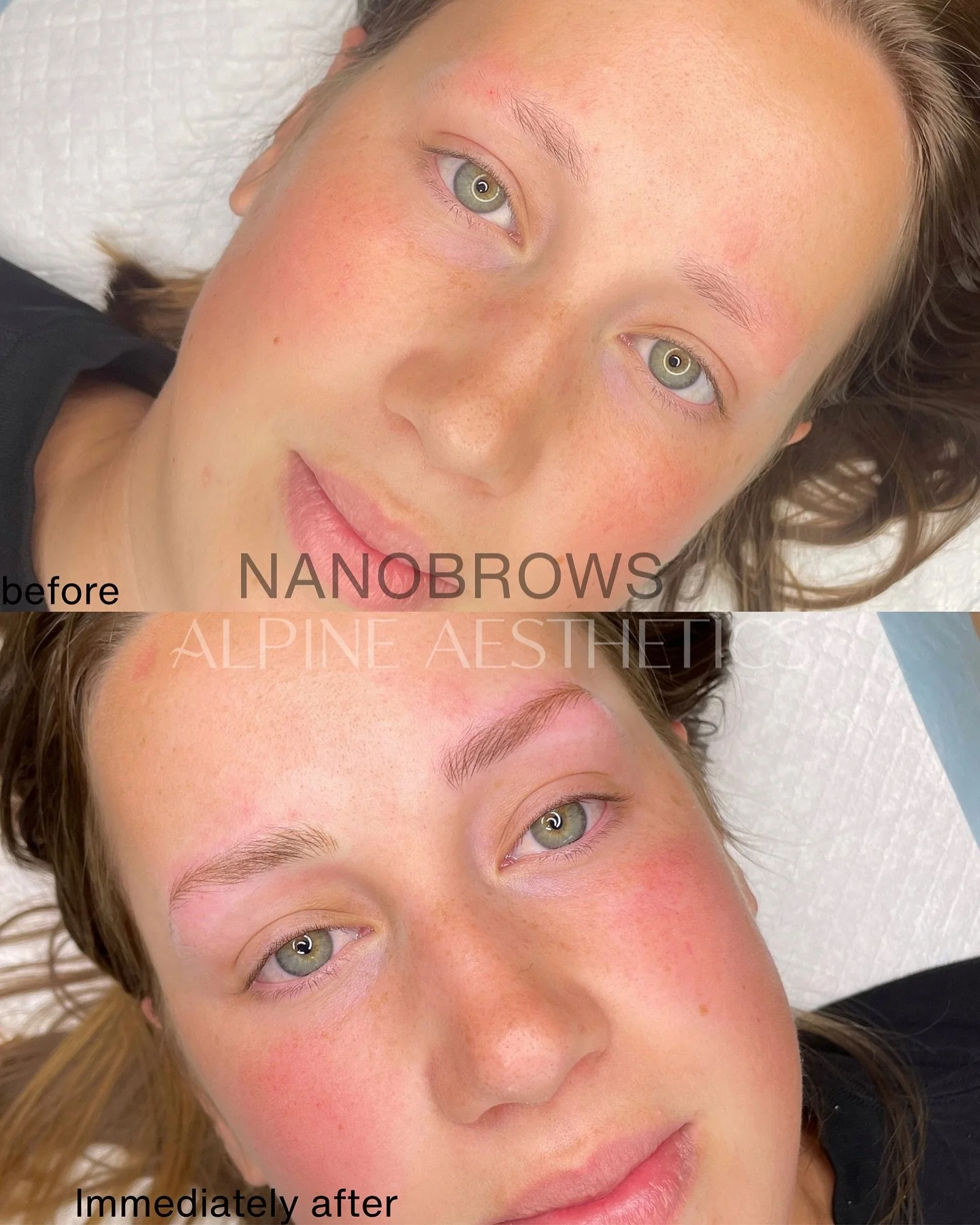 - NANO BROW TRANSFORMATION - 

After being turned away by other artists because it was going to be &ldquo;too hard&rdquo;. I relished in the opportunity to prove to this beautiful lady that she can have what she wants. 

WOW, these came with a lot of