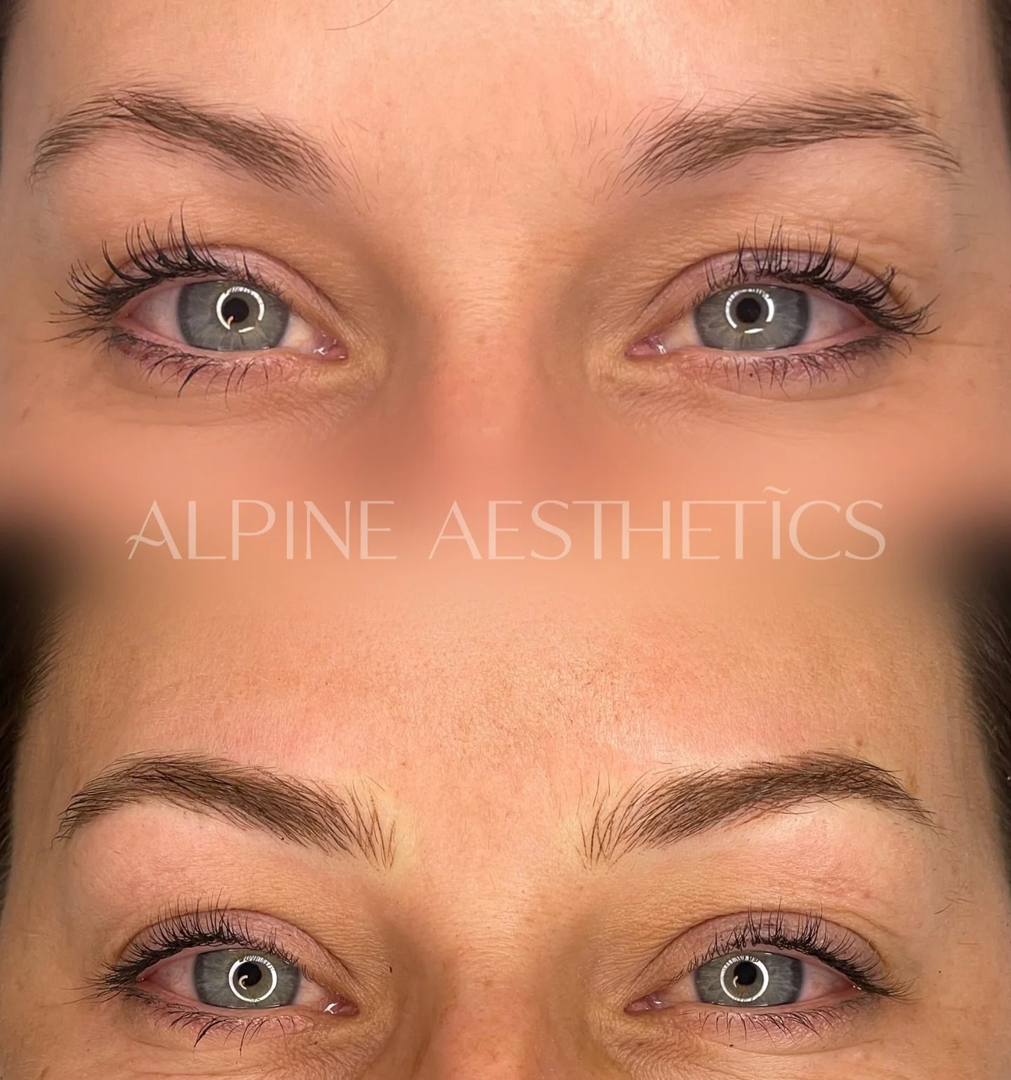 - NANO BROWS - Thankyou @shantellemcleod for being the most beautiful demo model for me today. 

A gorgeous soft natural nano brow, rebuilding the brows- filling in the gaps and remaining undetectable.

What do you guys think? Are you ready to take t