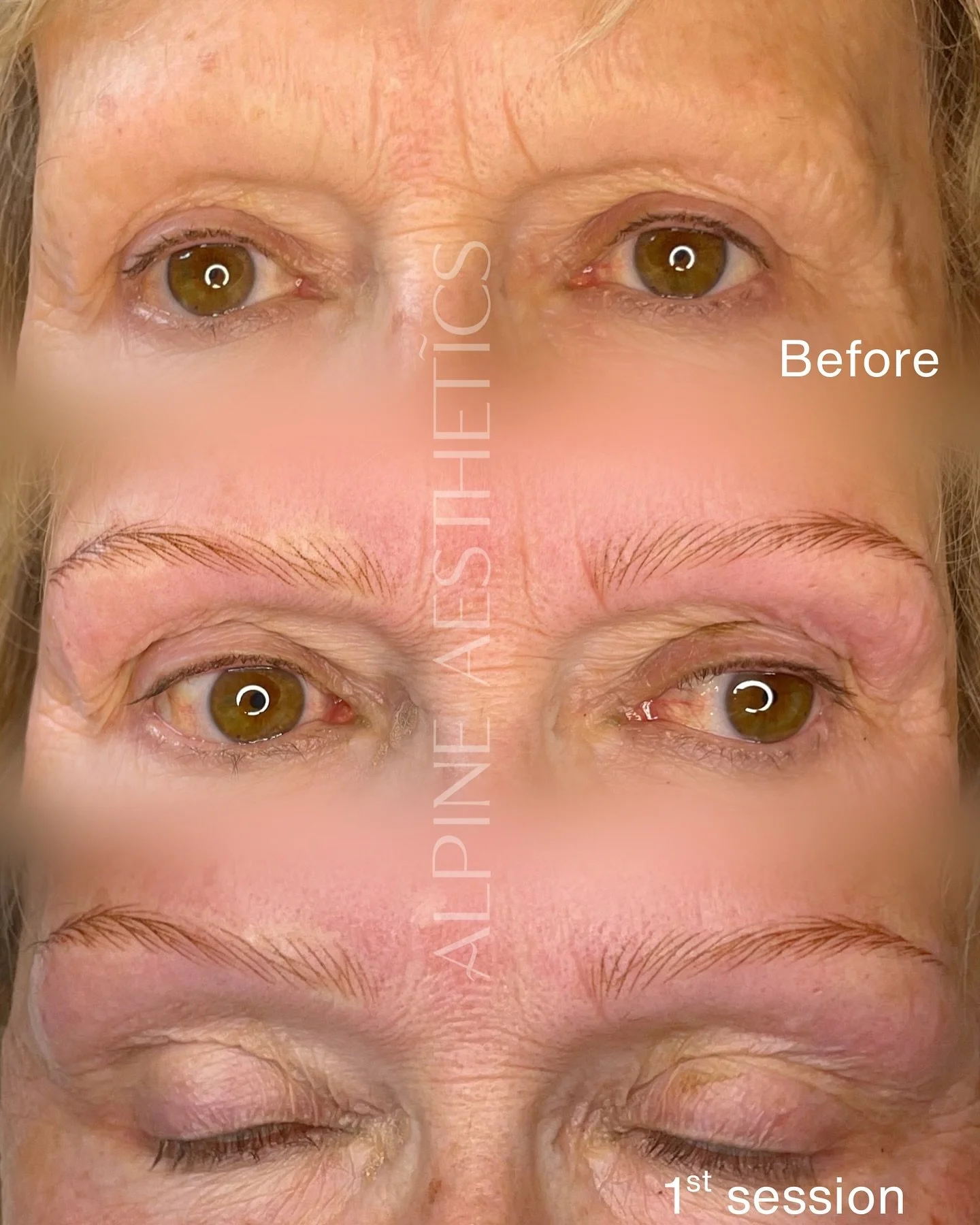 - Nano hair strokes- my beautiful brave client today.

I don&rsquo;t think these need any other explanation other than. 

Life changing.

Book yours today. Free consultations available. 

#nanobrows