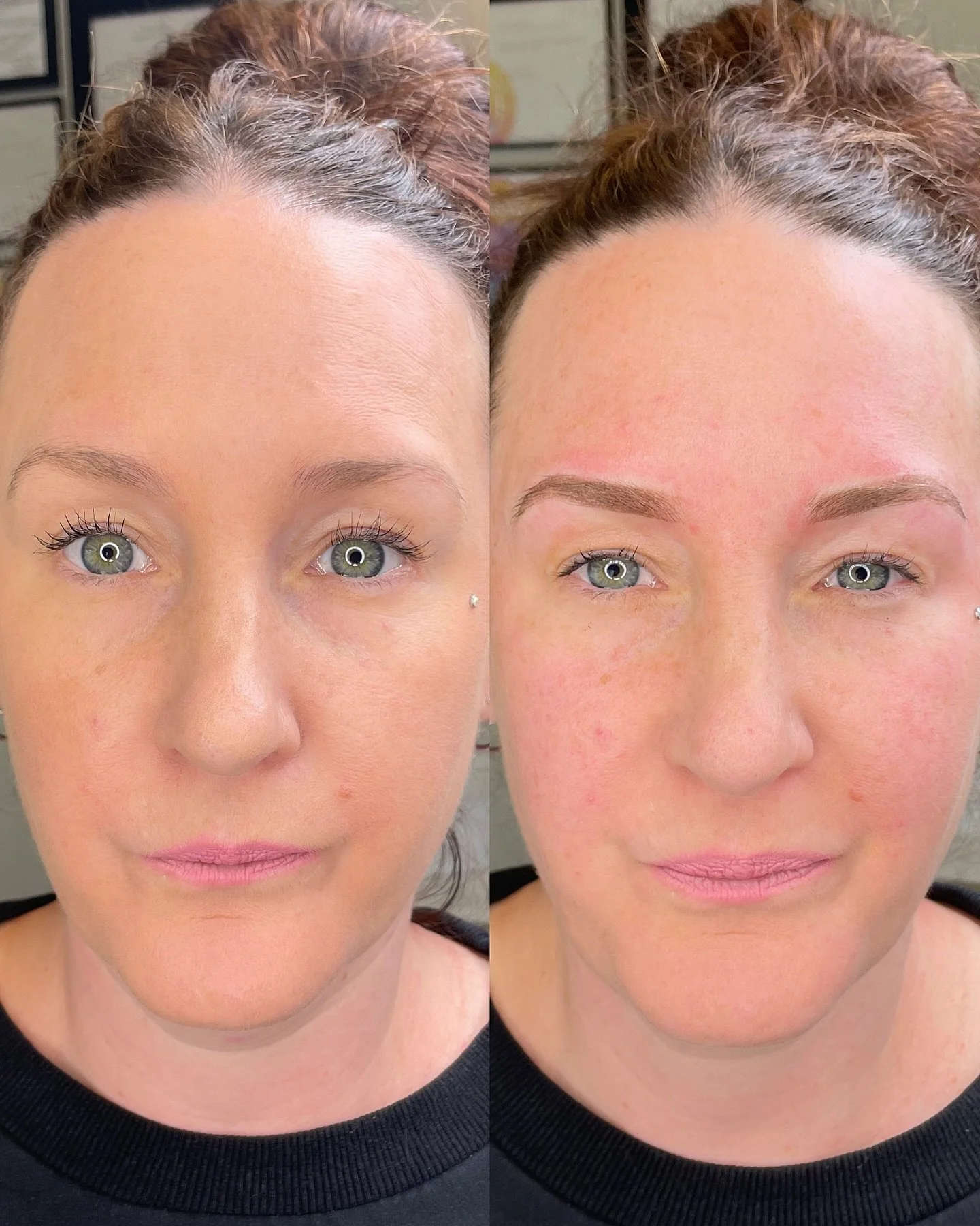 - STOP AND LOOK - and 👏 @vickieaiken I am so incredibly proud of you. 
It takes guts and courage to decide to change direction in career from nursing to this.. You&rsquo;ve done pre work, and your 3 days in to your 5 day / 6 week course of cosmetic 