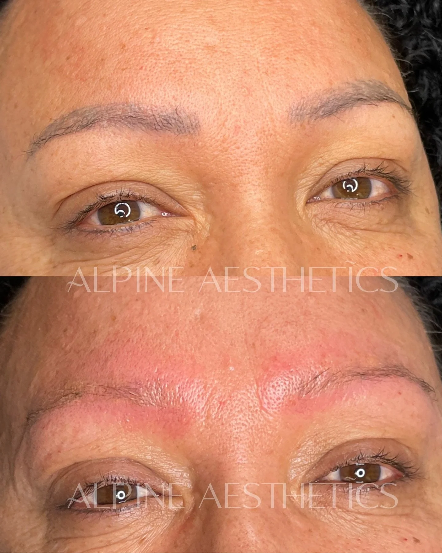- BROW REMOVAL - making way for some fresh new brows that are more modern in technique and style, subtle enough to look natural, but more than enough to feel fantastic. If you&rsquo;re in the market for some new brows and want to discuss your removal