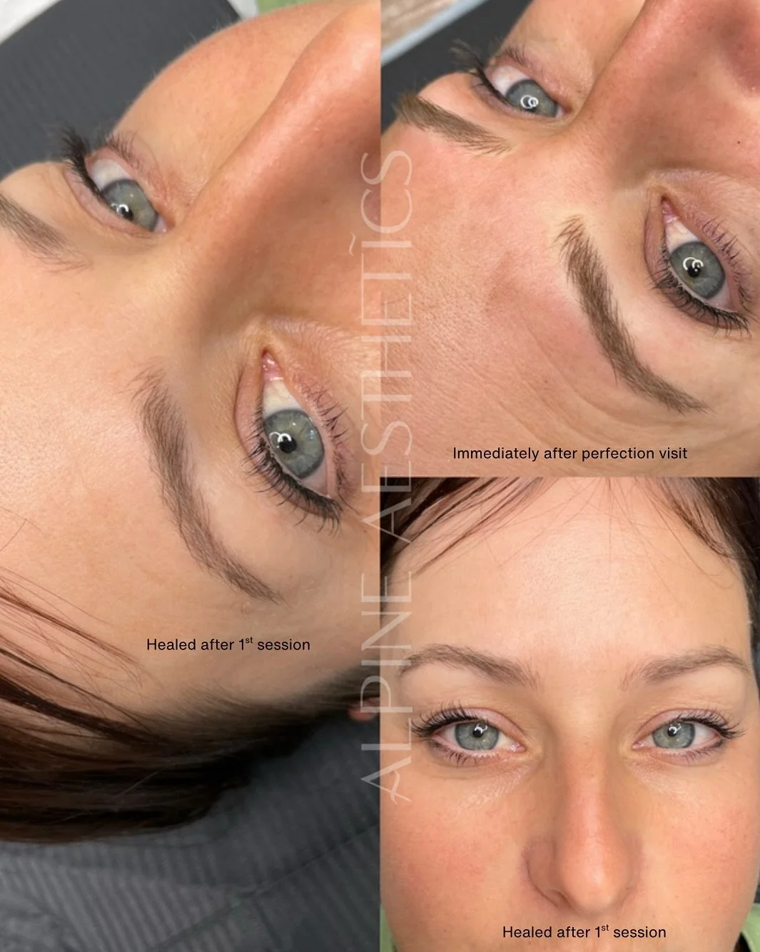 - HEALED NANO - before touch up. The goal? &ldquo;Soft nano strokes, enhancing my natural brow, fill in the gaps. Give me back what I once had&rdquo;. I think we nailed the brief. Such a stunning heal. This was my demo model for nano training with @s