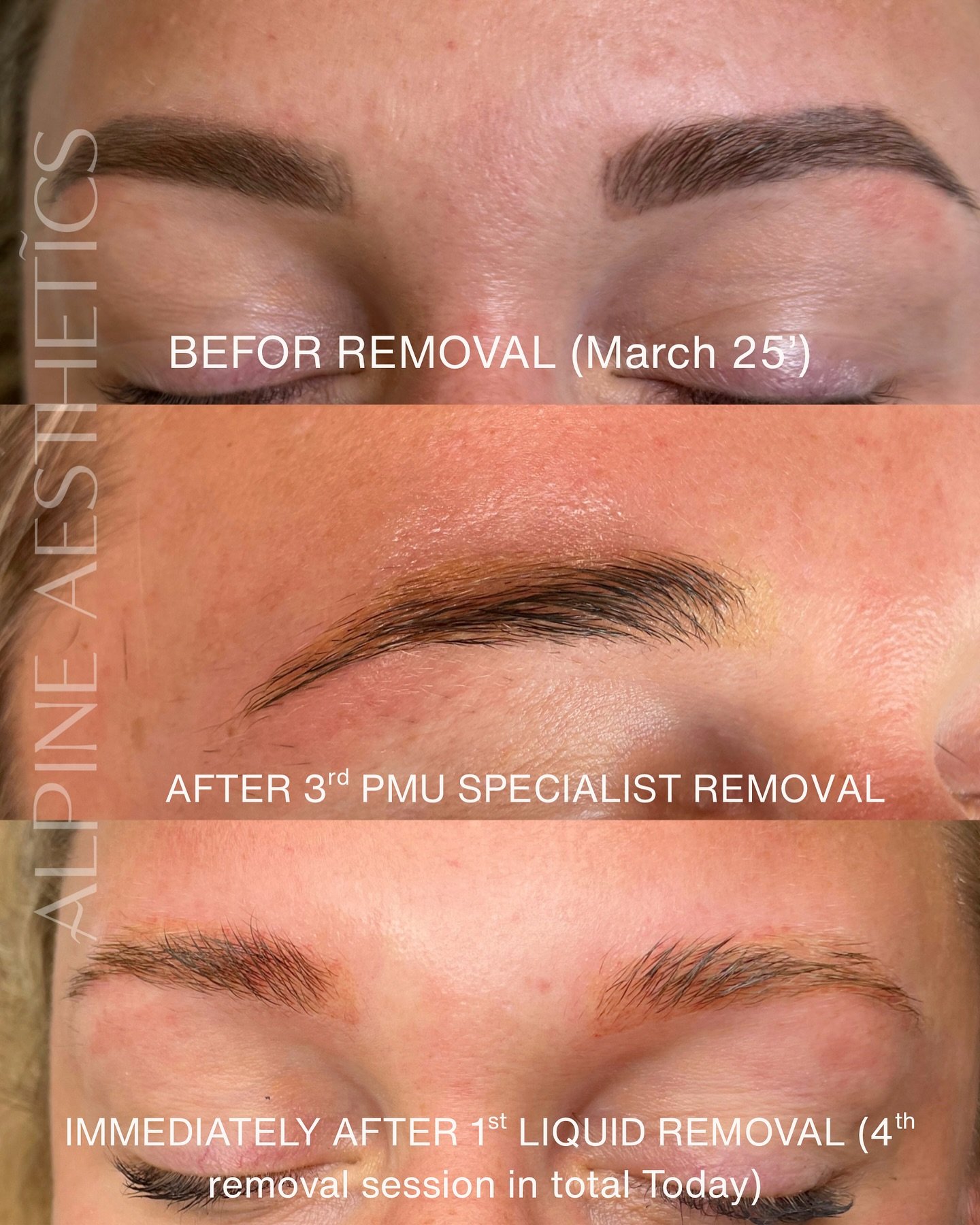 THE POWER OF TRUSTING THE PROCESS 😍

NEW BROWS LOADING&hellip;&hellip;. Watch this space. 

These were my beautiful client&rsquo;s brows back in March 2025 before we started (archive dive moment, original brows done by another artist), and we began 