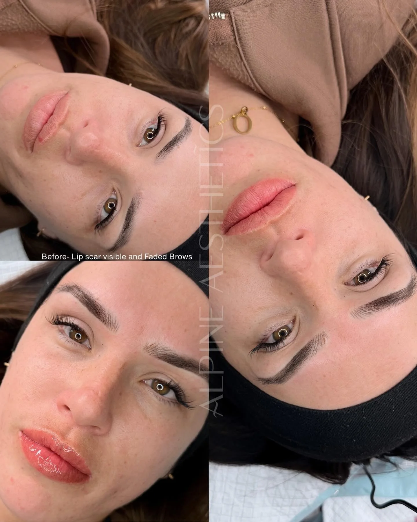 - LIPS AND BROWS - my beautiful sister wanted the scar on her lip to blend, and a natural finish for her lips. And a beautiful top up on her brows that we did 18months ago. Her lips were initially done 2 years ago! So it was time for a refresh! 

Als
