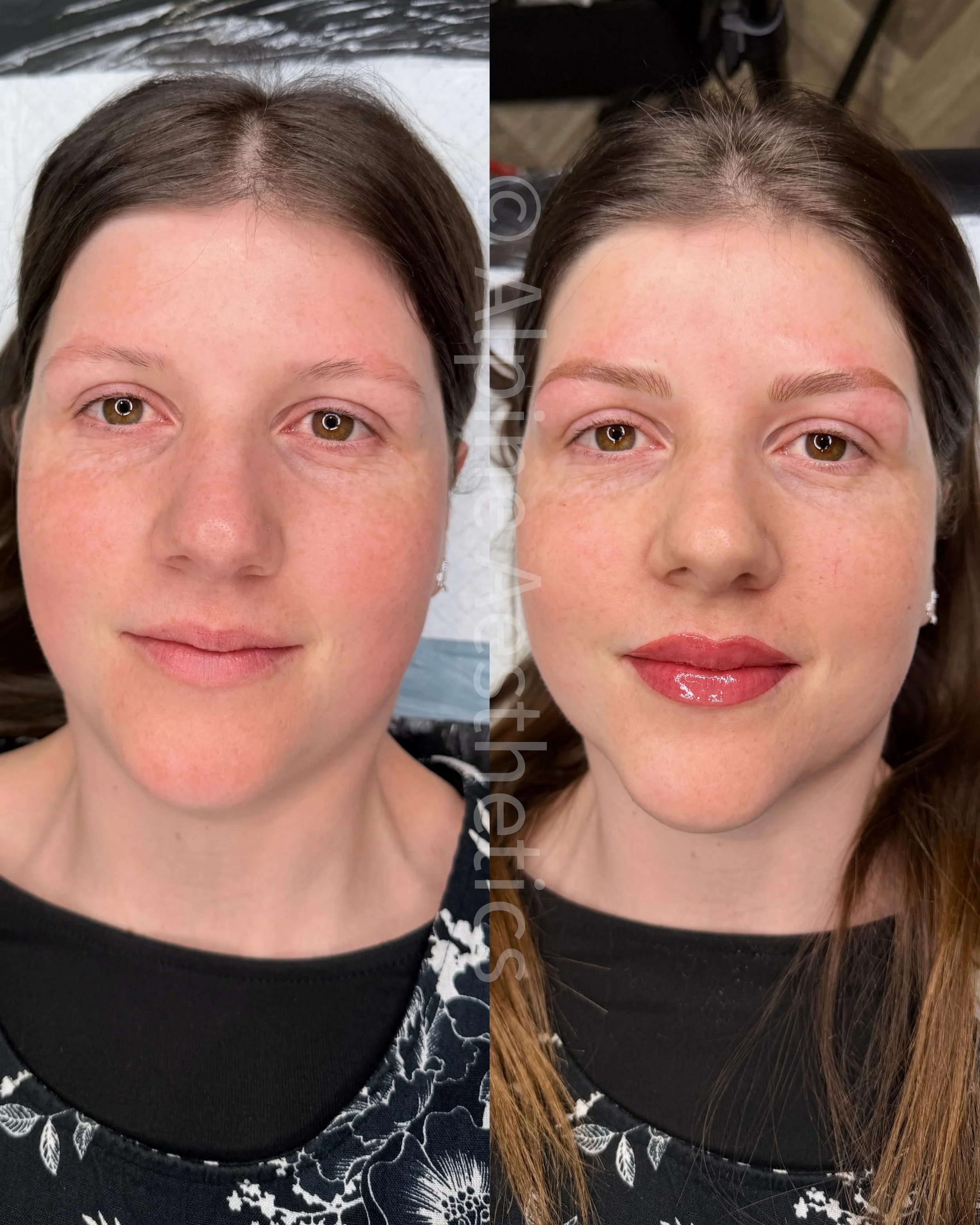 - Ultimate transformation- Brows and Lips for my girl @cillakaye who has been patiently waiting post removal to have some beautiful soft brows again. And she opted for the most stunning colour of lip blush! 
Absolutely OBSESSSED! What do you guys thi