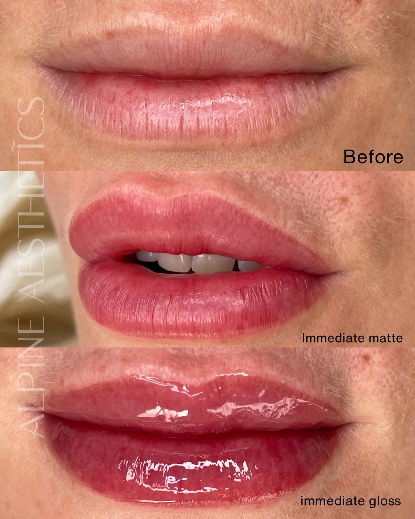 - LIP BLUSH SHEER - my gawwwd. How obsessed. I absolutely ADORE this colour for my client. She came to me wanting more shape, more colour. and we delivered.

I just cannot get over how perfect this treatment is! It gives feminine, yet boss bitch vibe