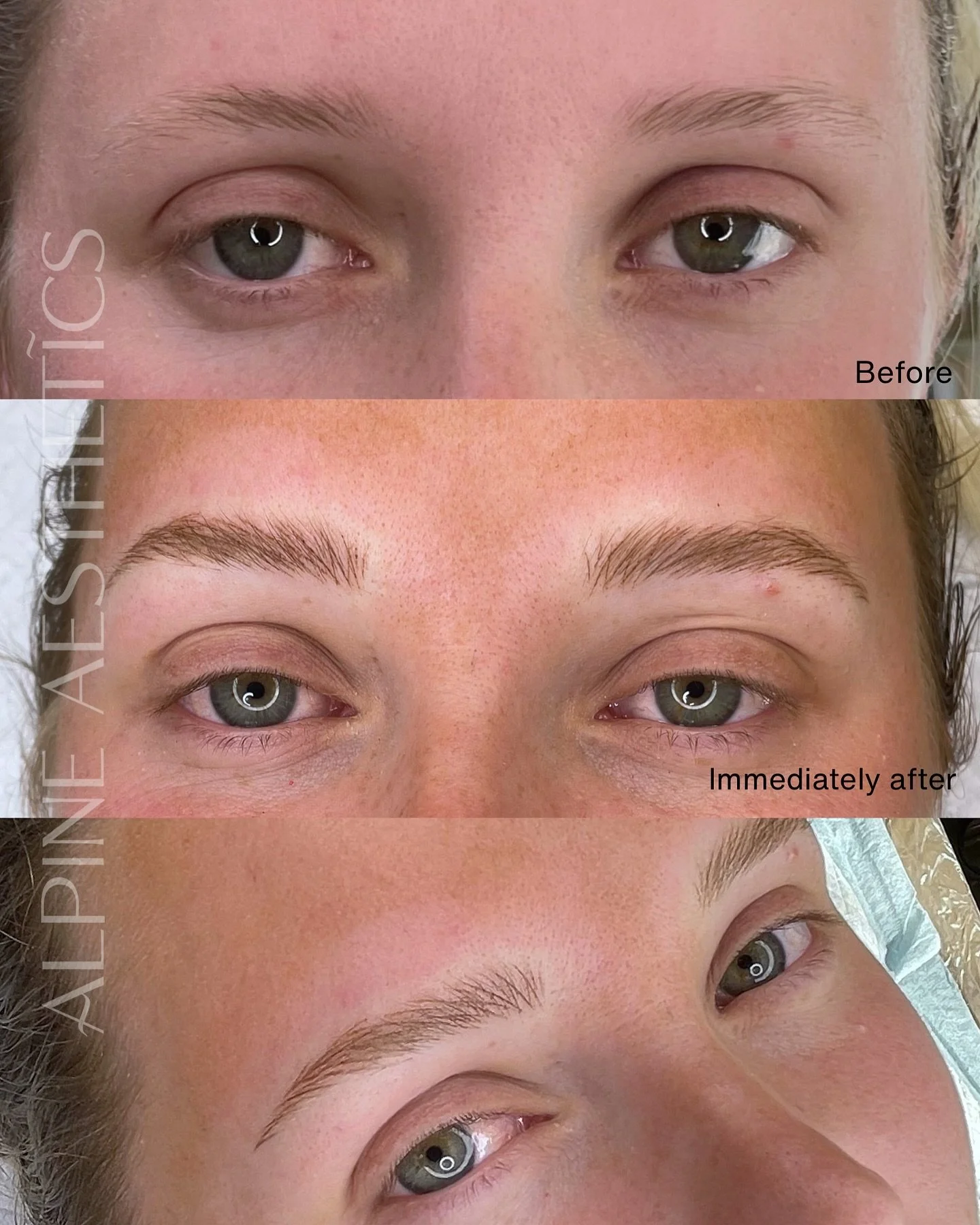 The appointment you hesitated on&hellip;. 

- BLONDE NANO BROWS -

WOW. These brows have completely transformed her face&hellip; and yet somehow still look like they&rsquo;ve always belonged there. 🤍

A subtle lift through the brow has opened her ey