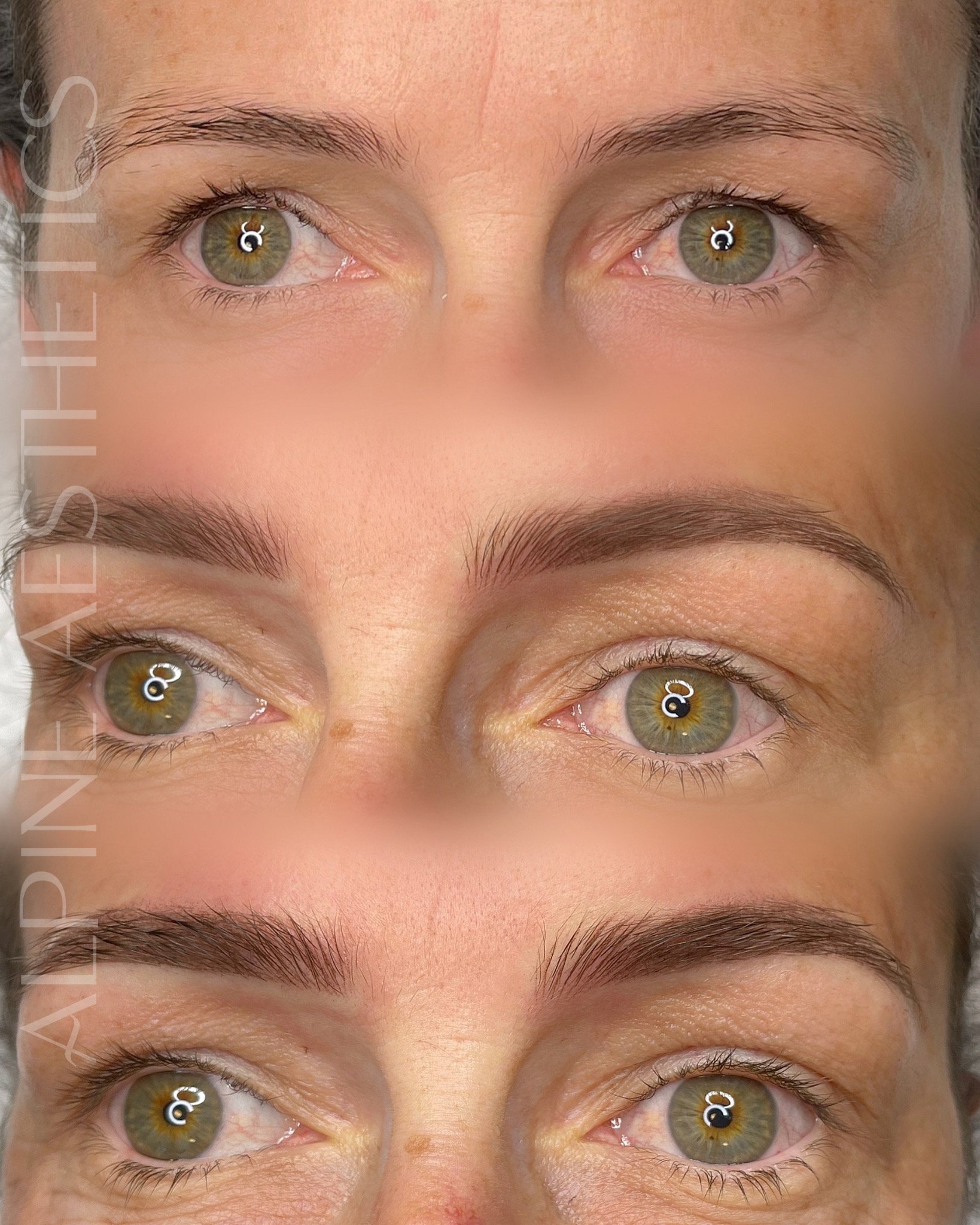 Before and After combination Brow