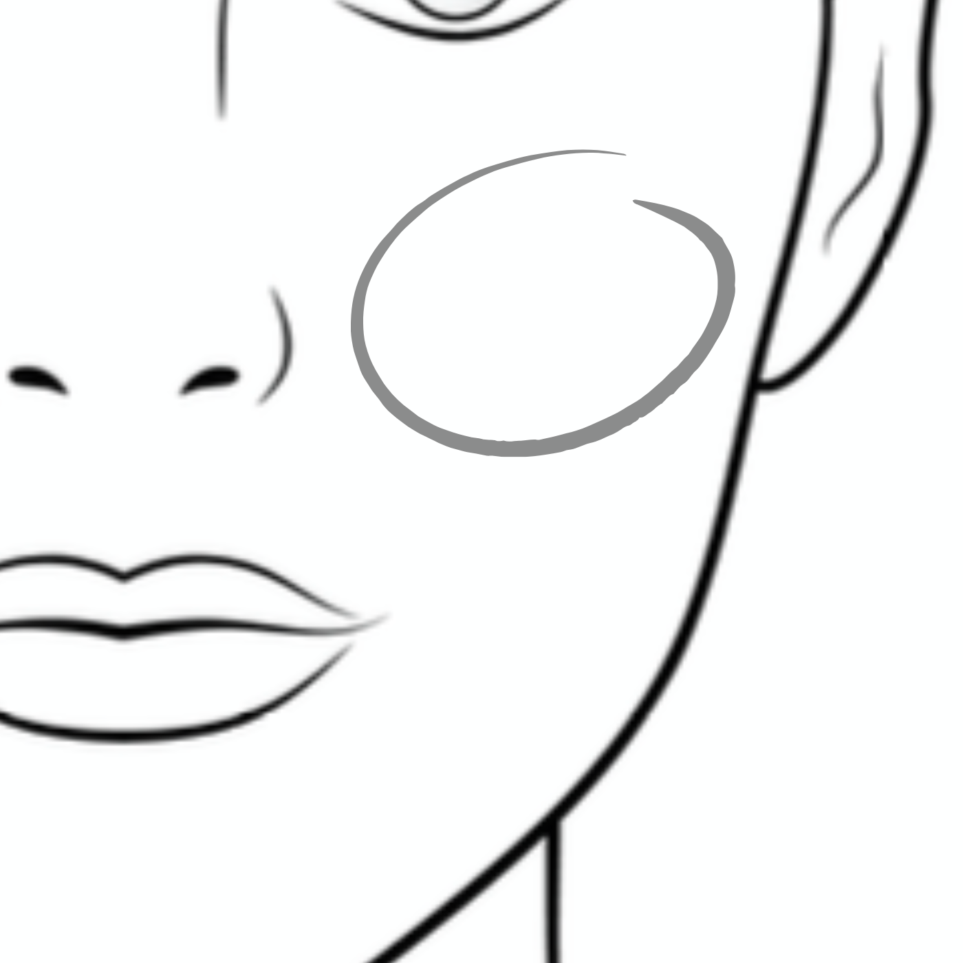 Dermal Filler Halifax