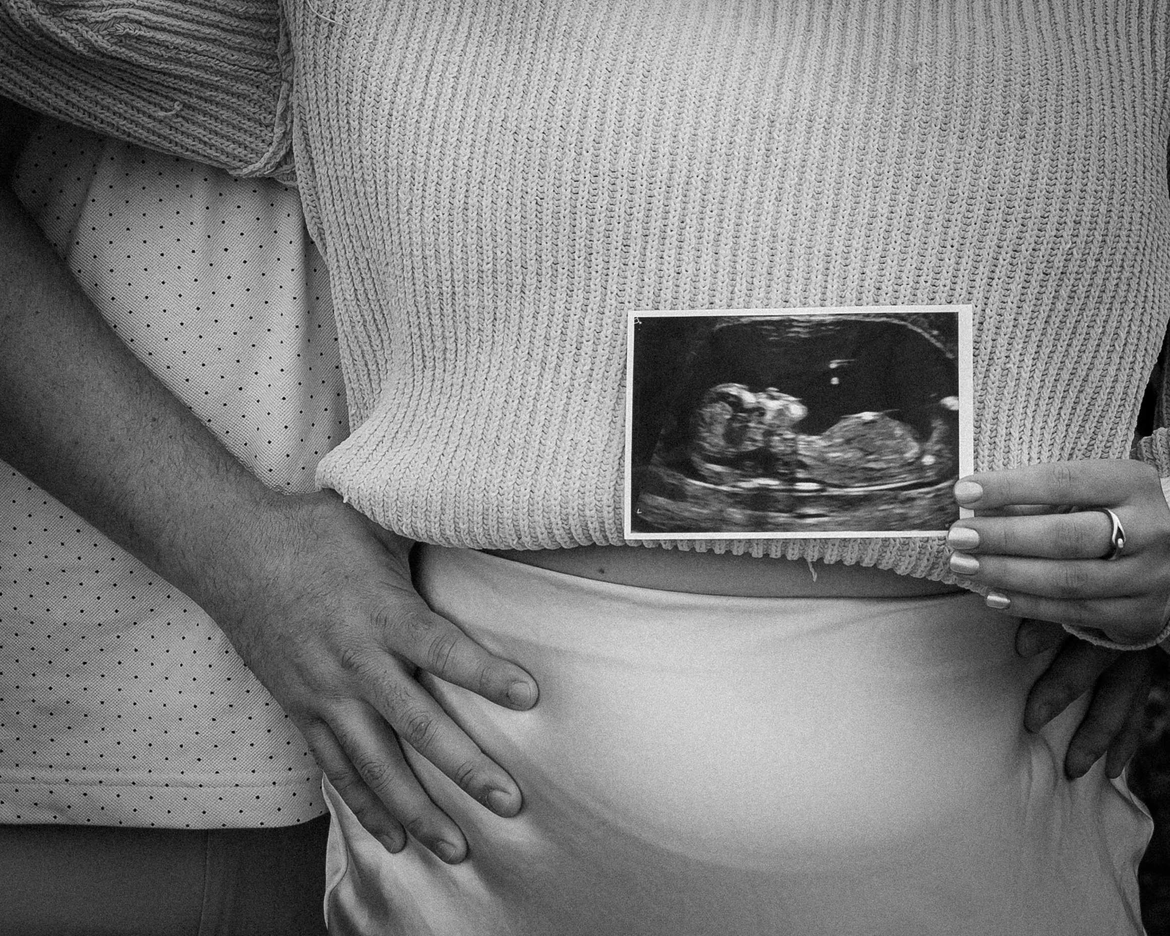 Black and white pregnancy announcement with ultrasound photo held over belly. Photo is a close up of the couples midsection. Taken in St. Albert