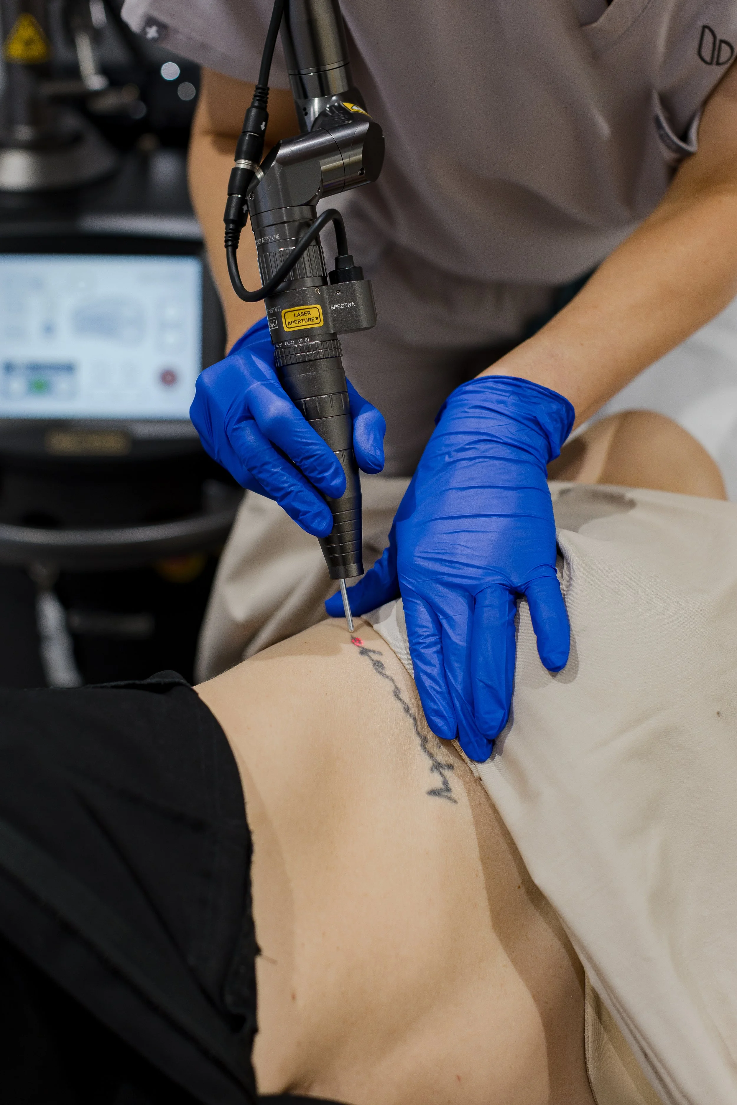 A person receiving a tattoo on their side in a tattoo studio, with a tattoo artist using a tattoo machine while wearing blue gloves.