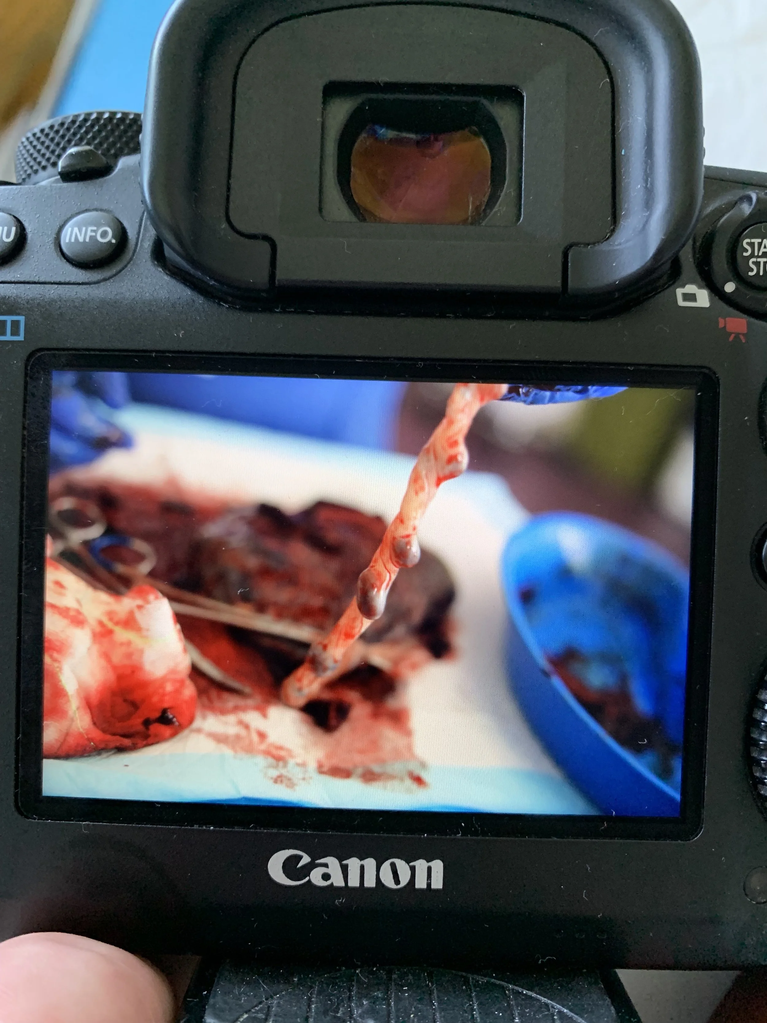 a photo on a canon camera of a placenta