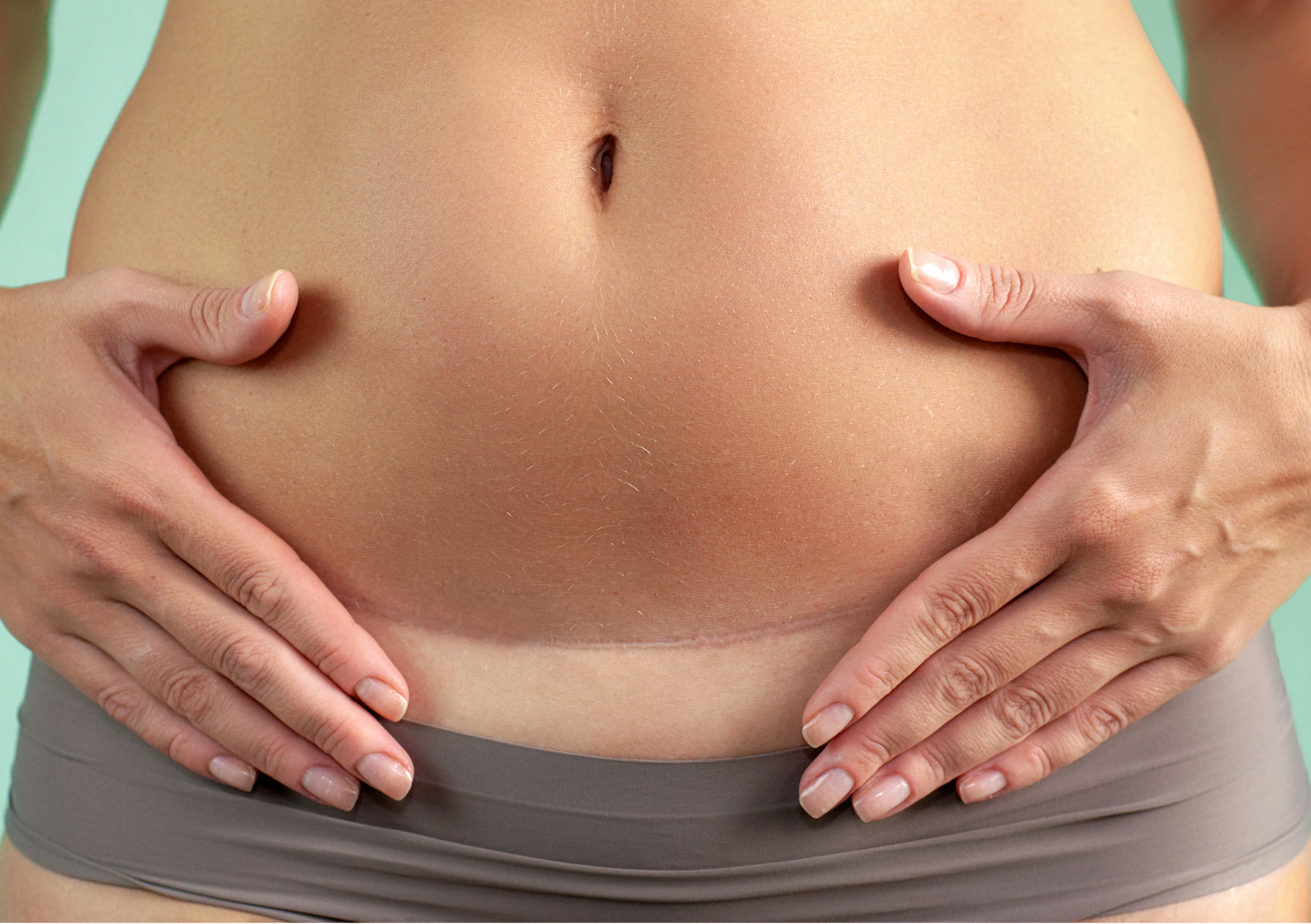 Postpartum Acupuncture in Melbourne: Supporting Recovery After Birth