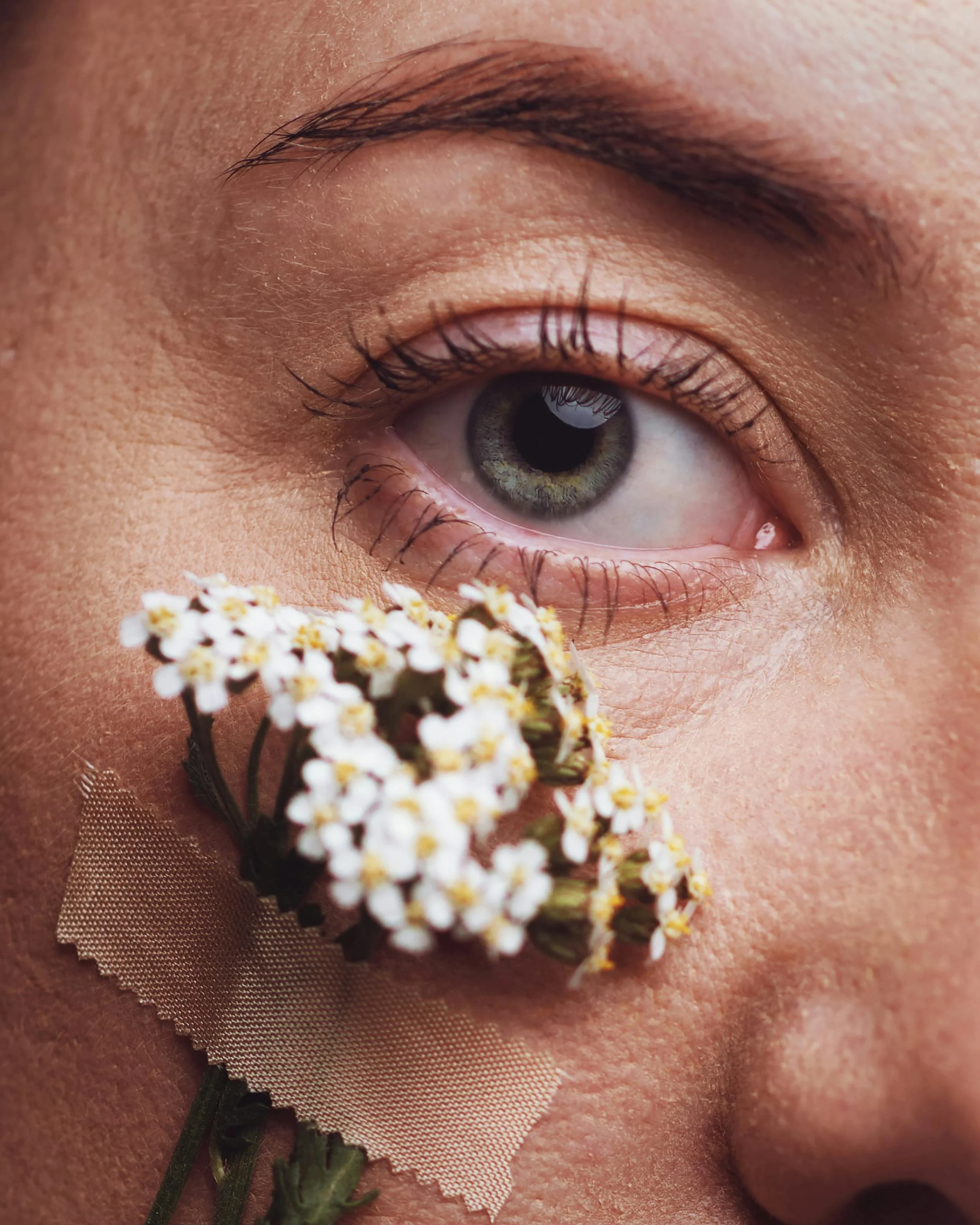 COMPLEX CASE PLAYBOOK: REDNESS