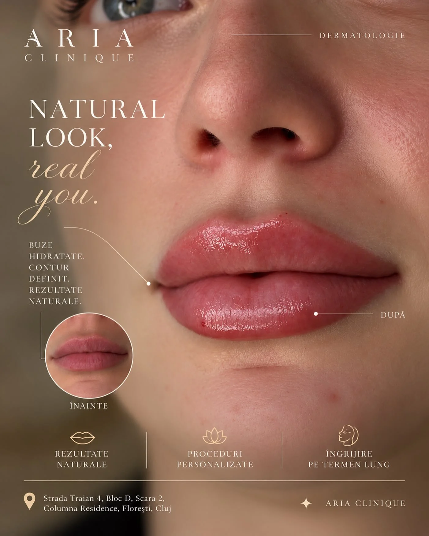 Frumusețea stă &icirc;n echilibru. &Icirc;n proporții armonioase, contur delicat și rezultate care păstrează naturalețea trăsăturilor tale. ✨

&Icirc;n cadrul departamentului de Dermatologie &amp; Estetică Medicală ARIA CLINIQUE, fiecare procedură es