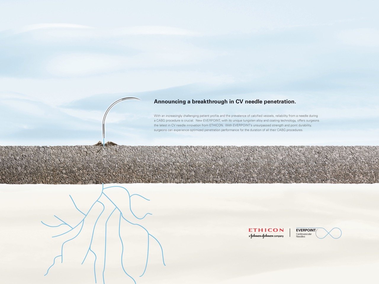 Art Directed this Winning Concept for J&J. Image of a medical needle protruding from the ground with blue veins illustrated beneath, symbolizing advancements in cardiovascular treatment.